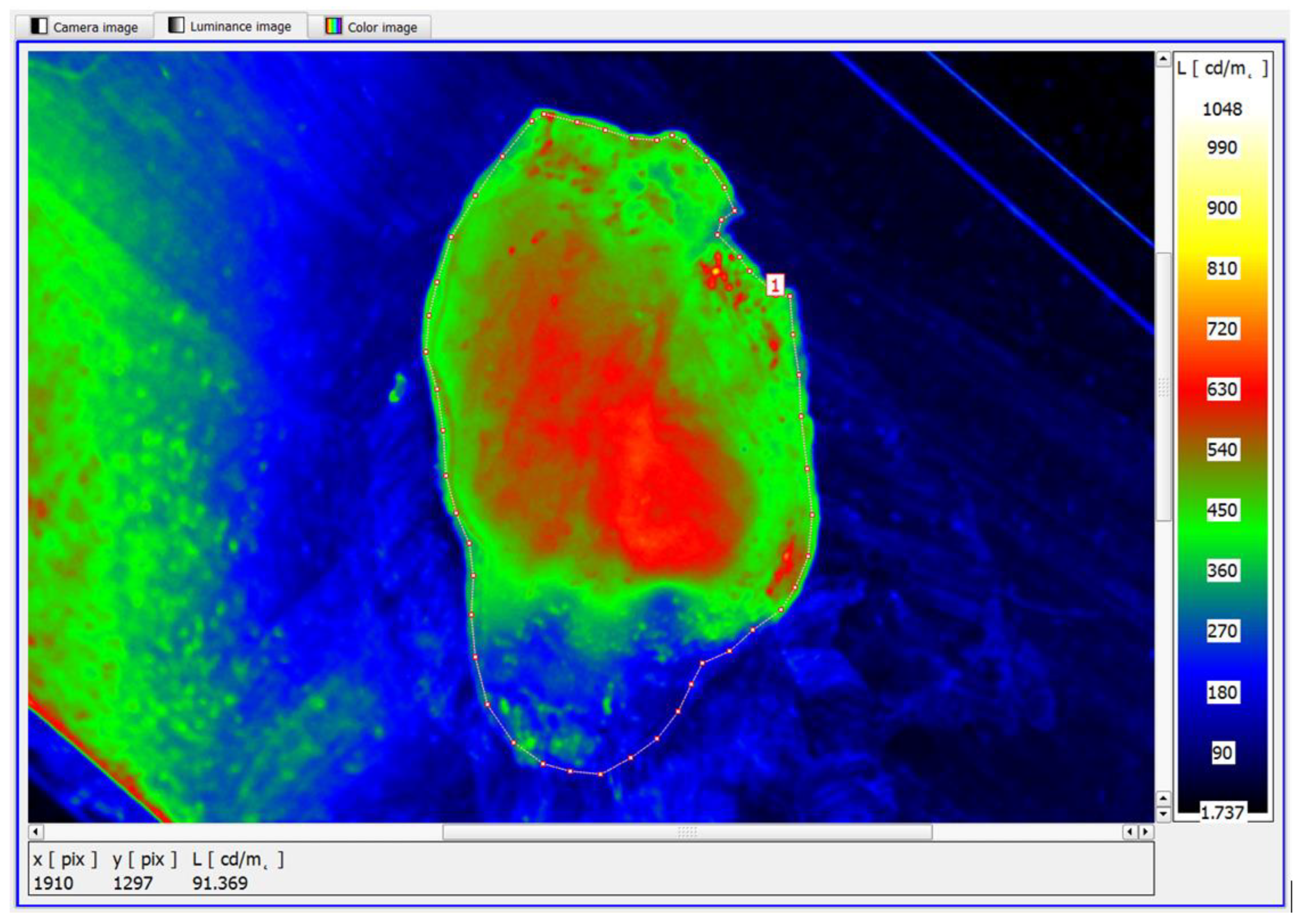 Cancers 17 00639 g011