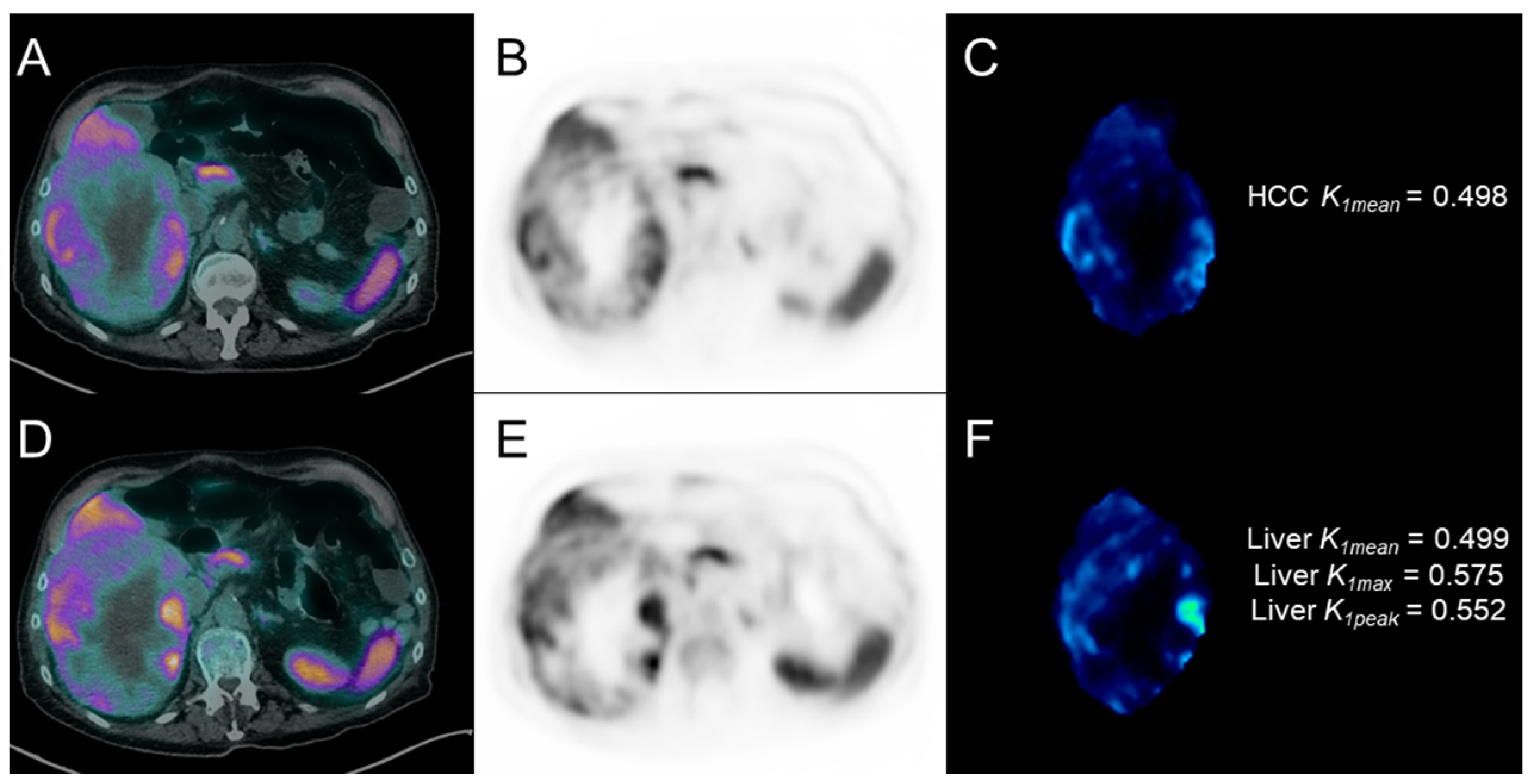 Cancers 17 00656 g006