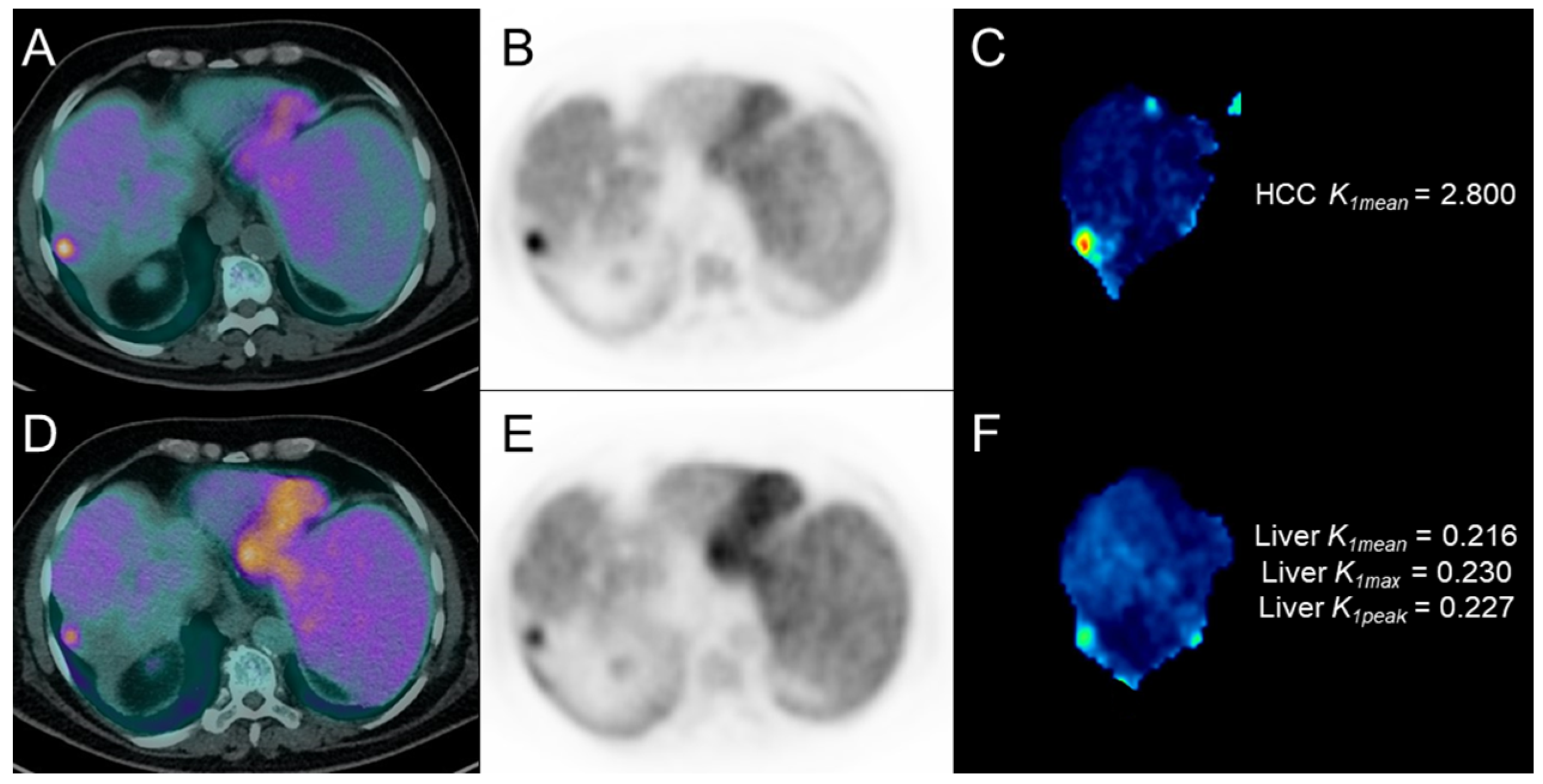 Cancers 17 00656 g007