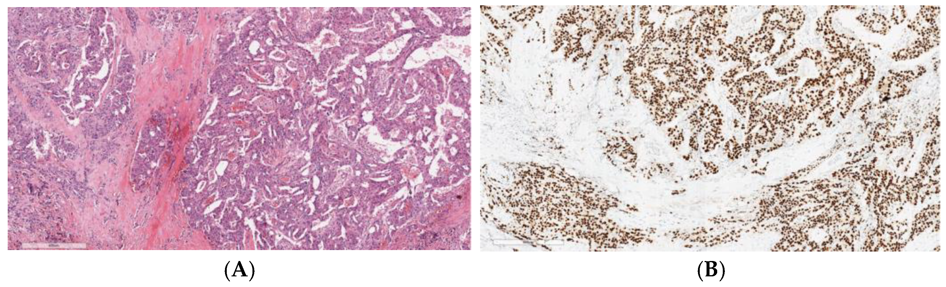 Cancers 17 00660 g001