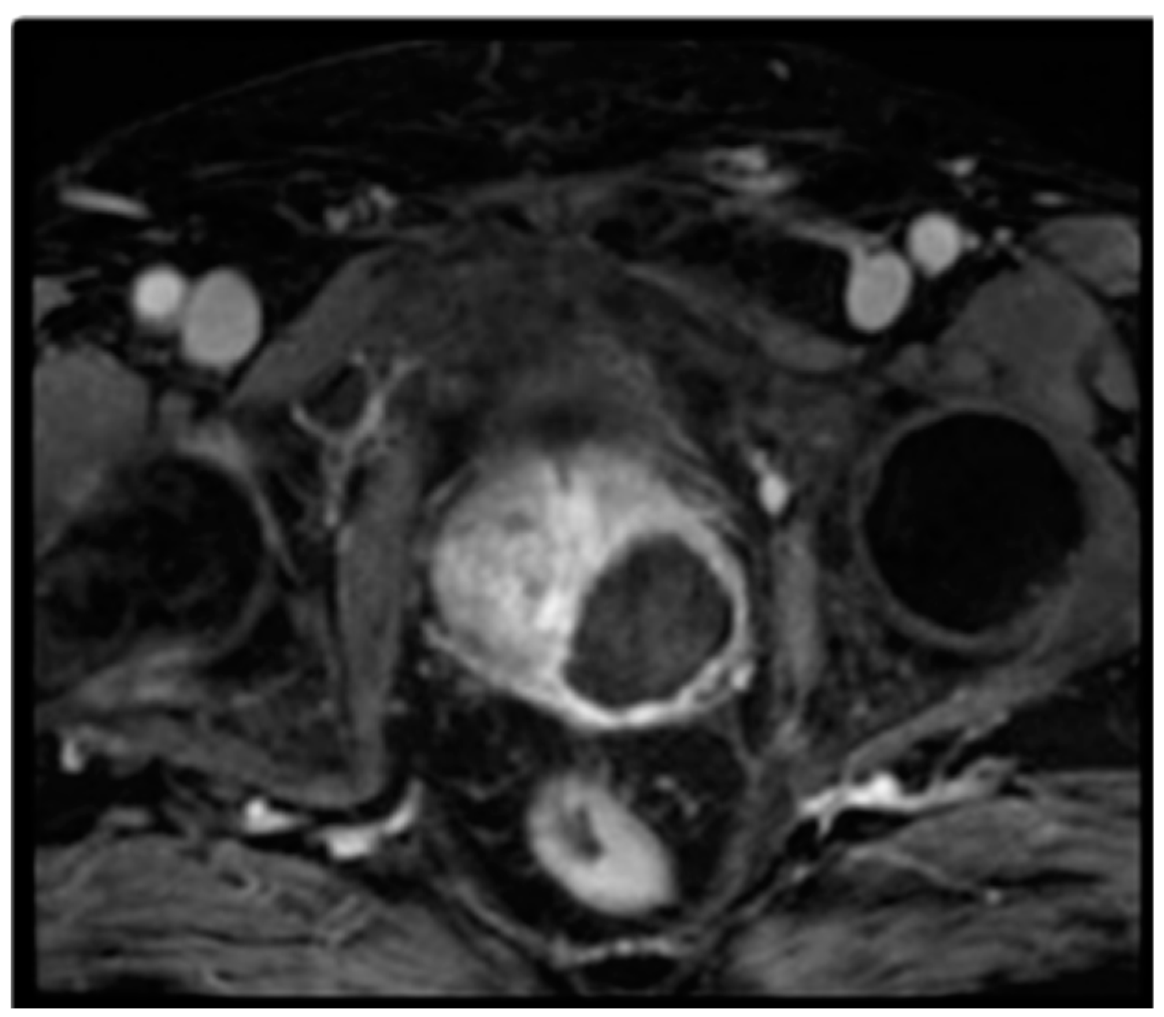 Cancers 17 00661 g003 Cancers 17 00661 g003