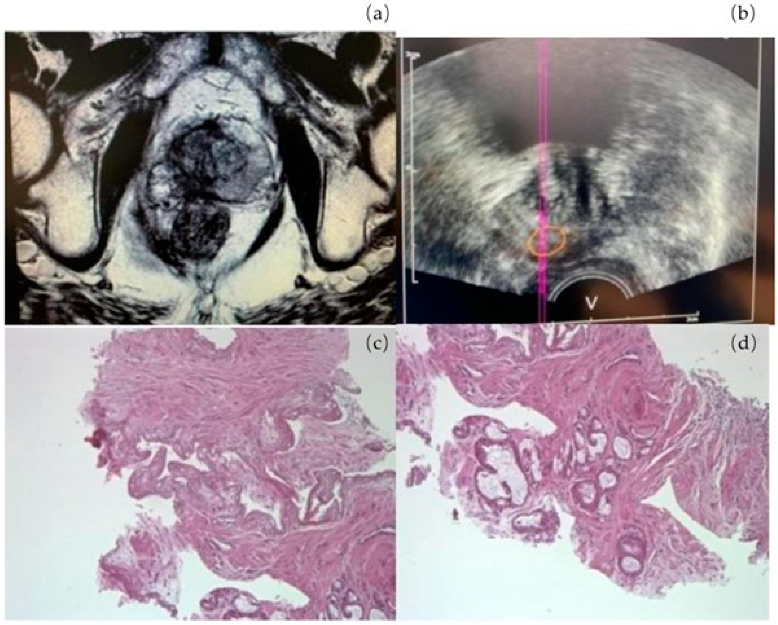 Cancers 17 00661 g004 Cancers 17 00661 g004