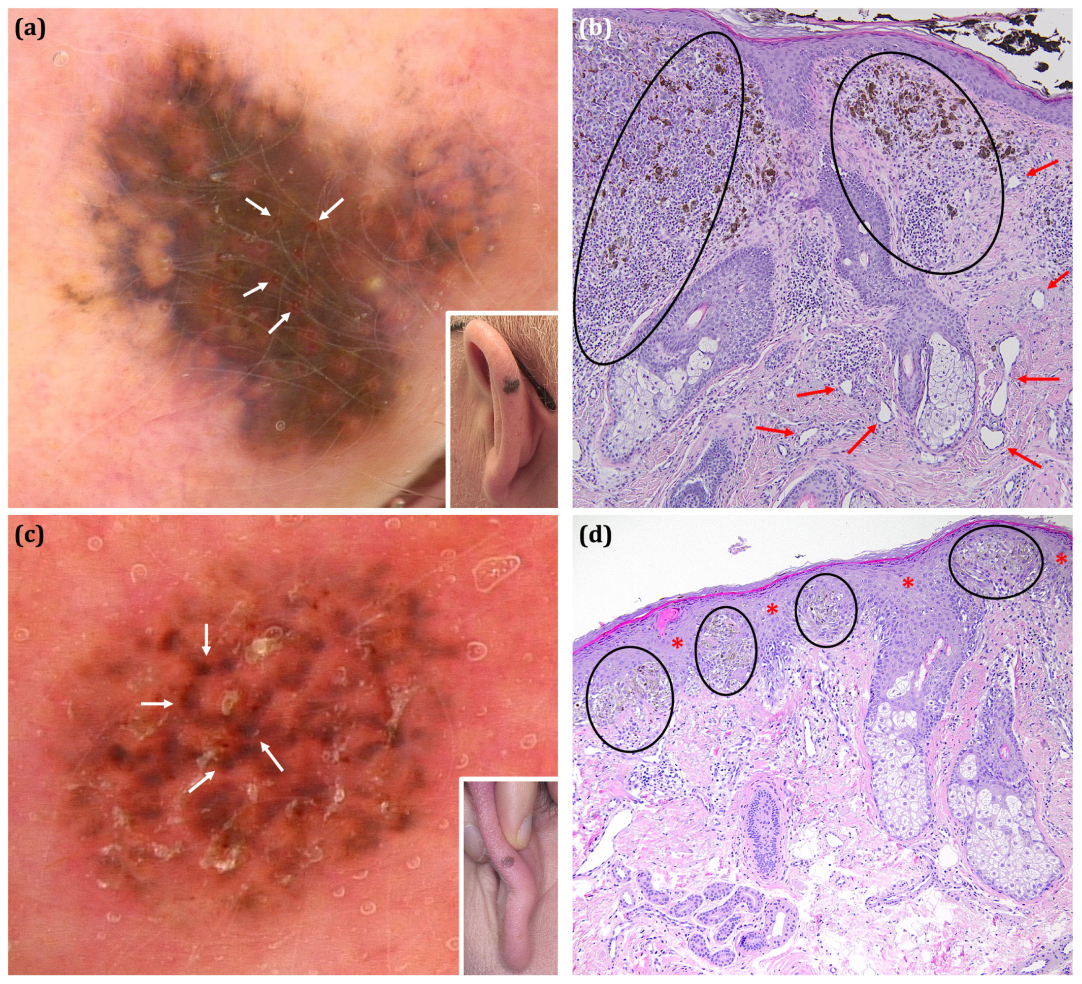 Cancers 17 00679 g001