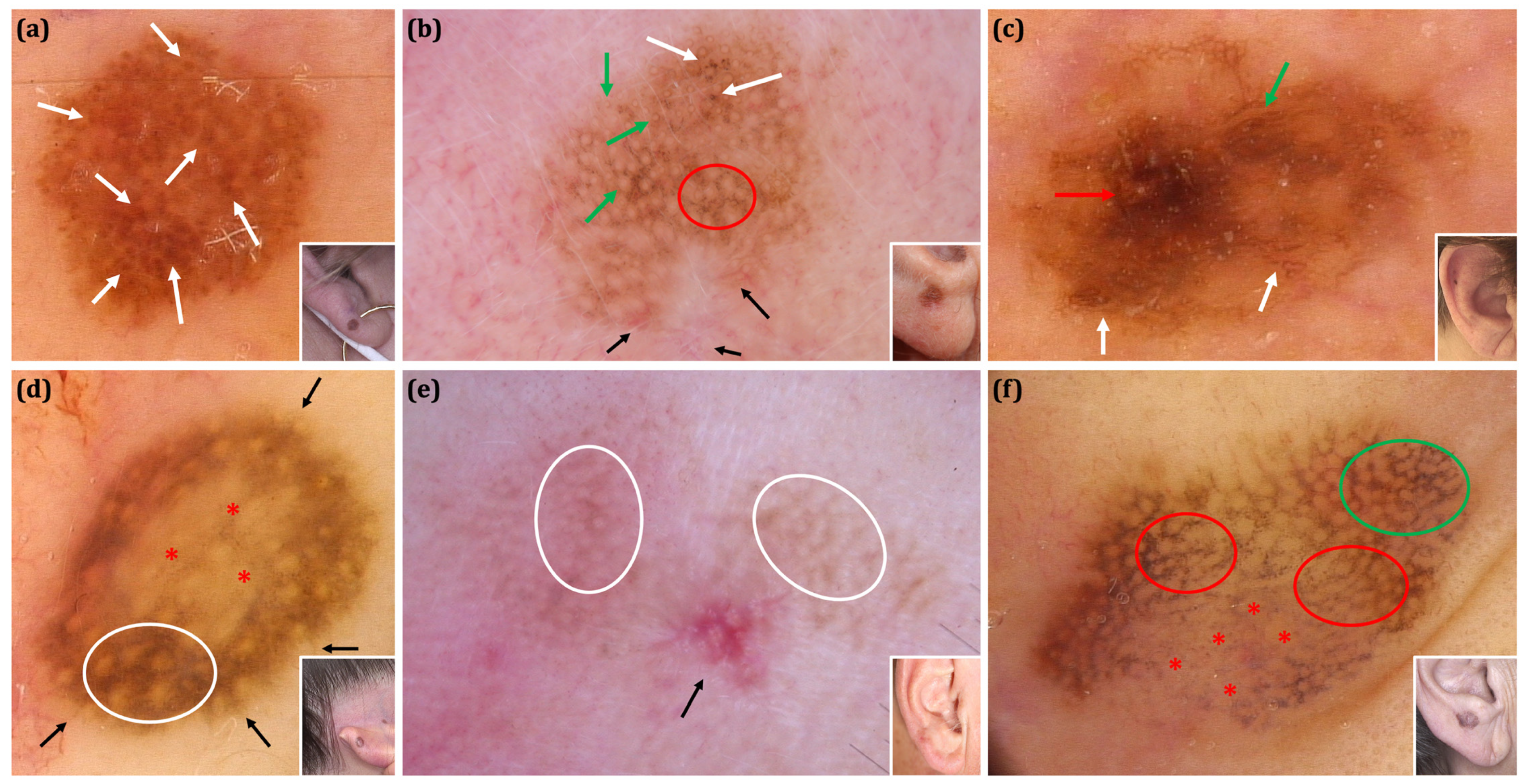 Cancers 17 00679 g003