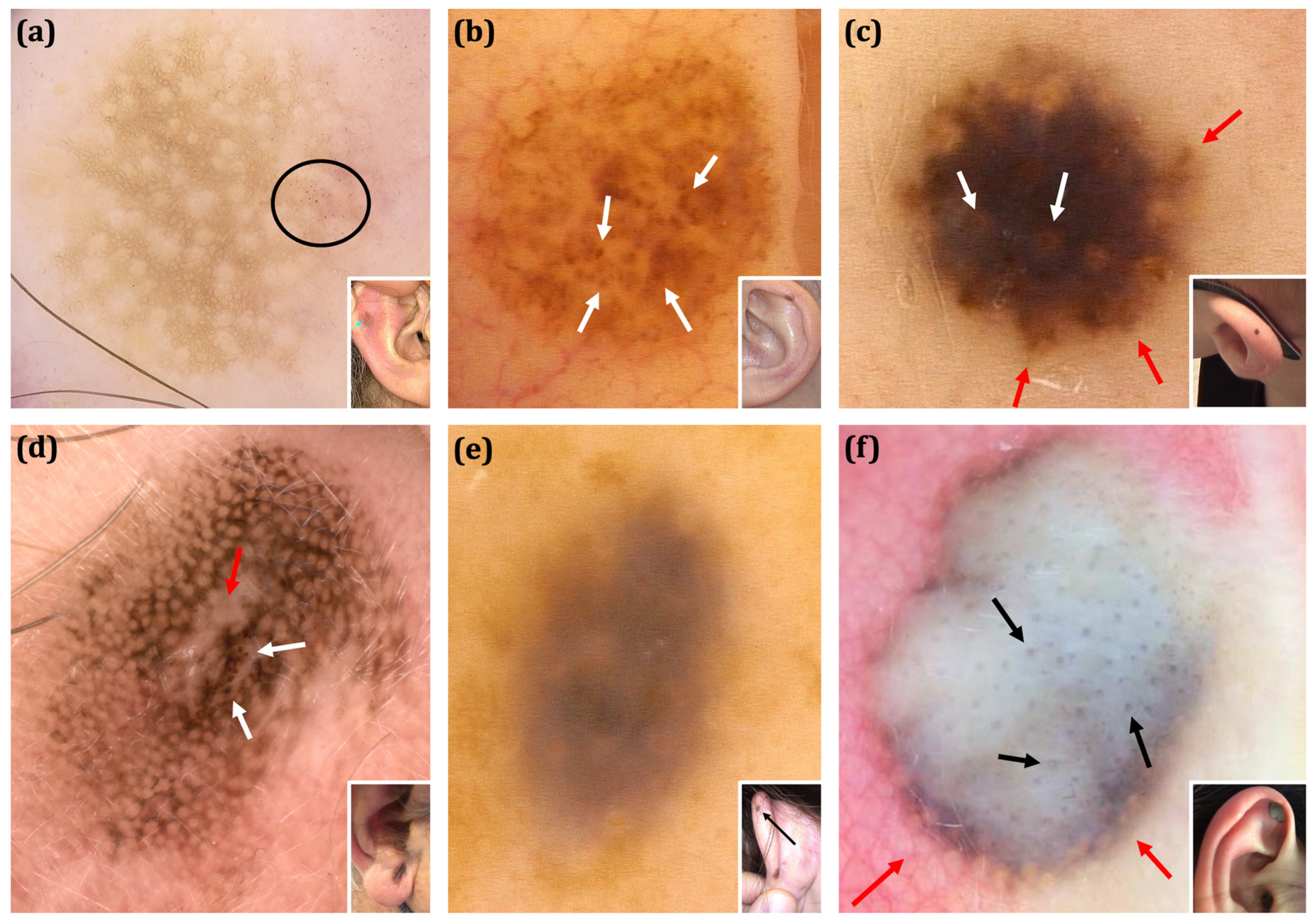 Cancers 17 00679 g004