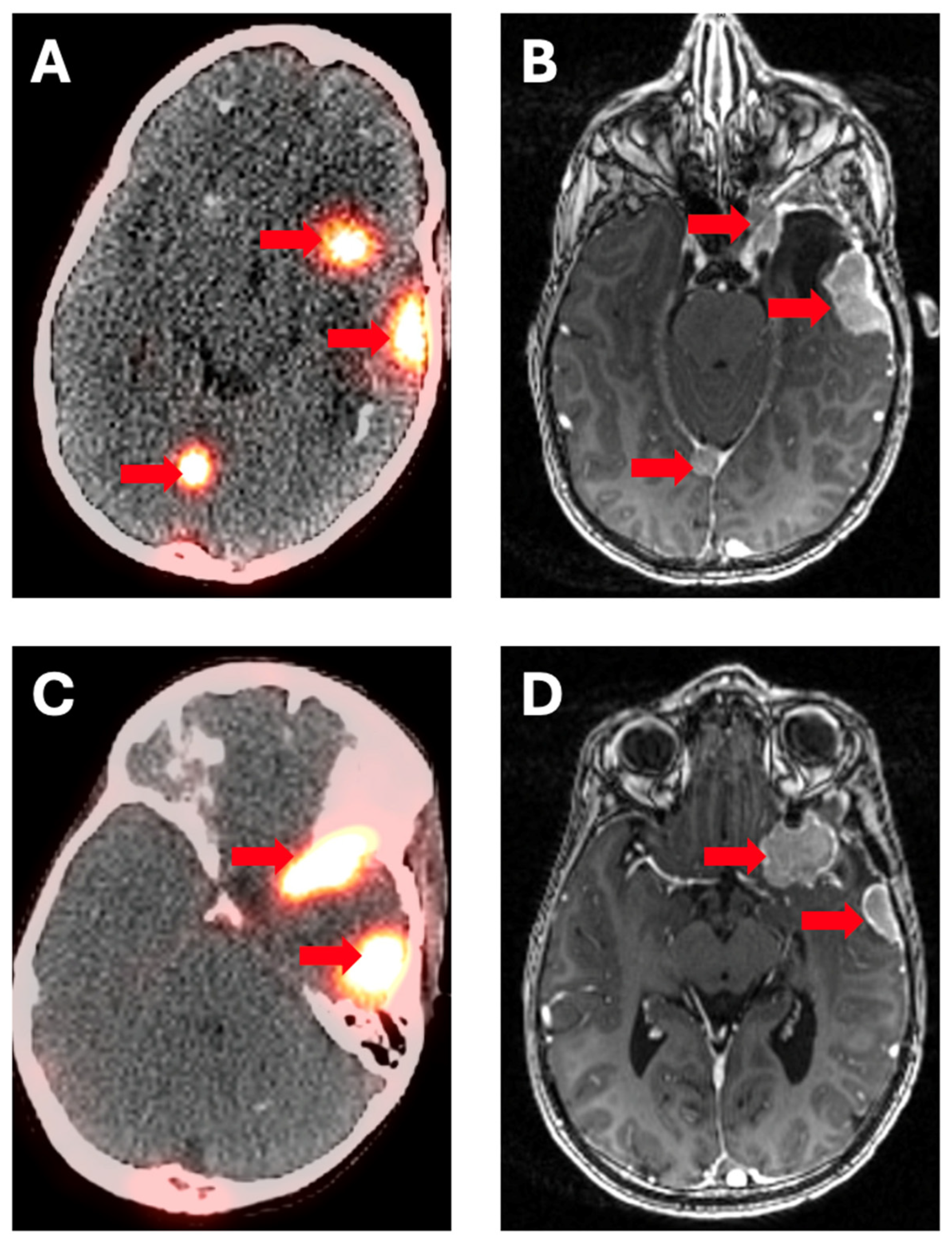 Cancers 17 00695 g002