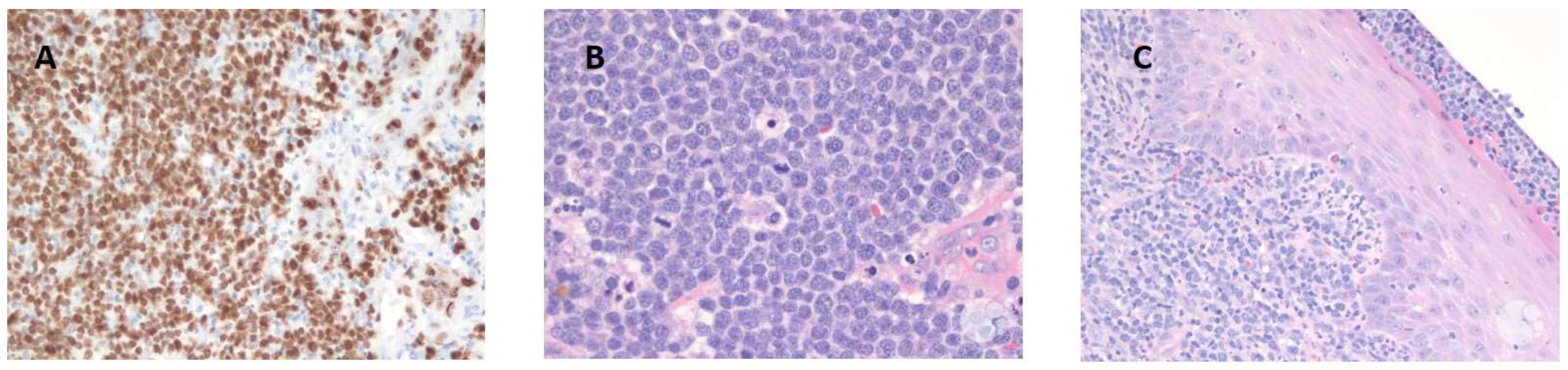 Cancers 17 00696 g002