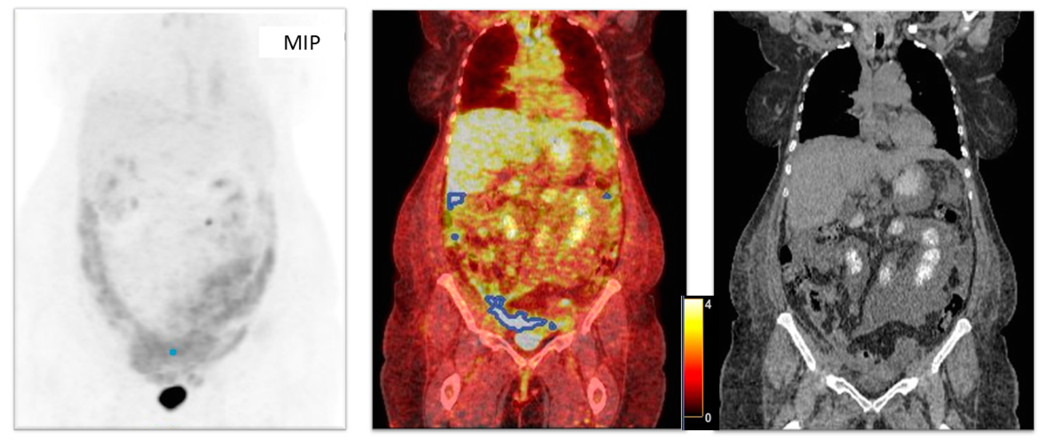 Cancers 17 00698 g003