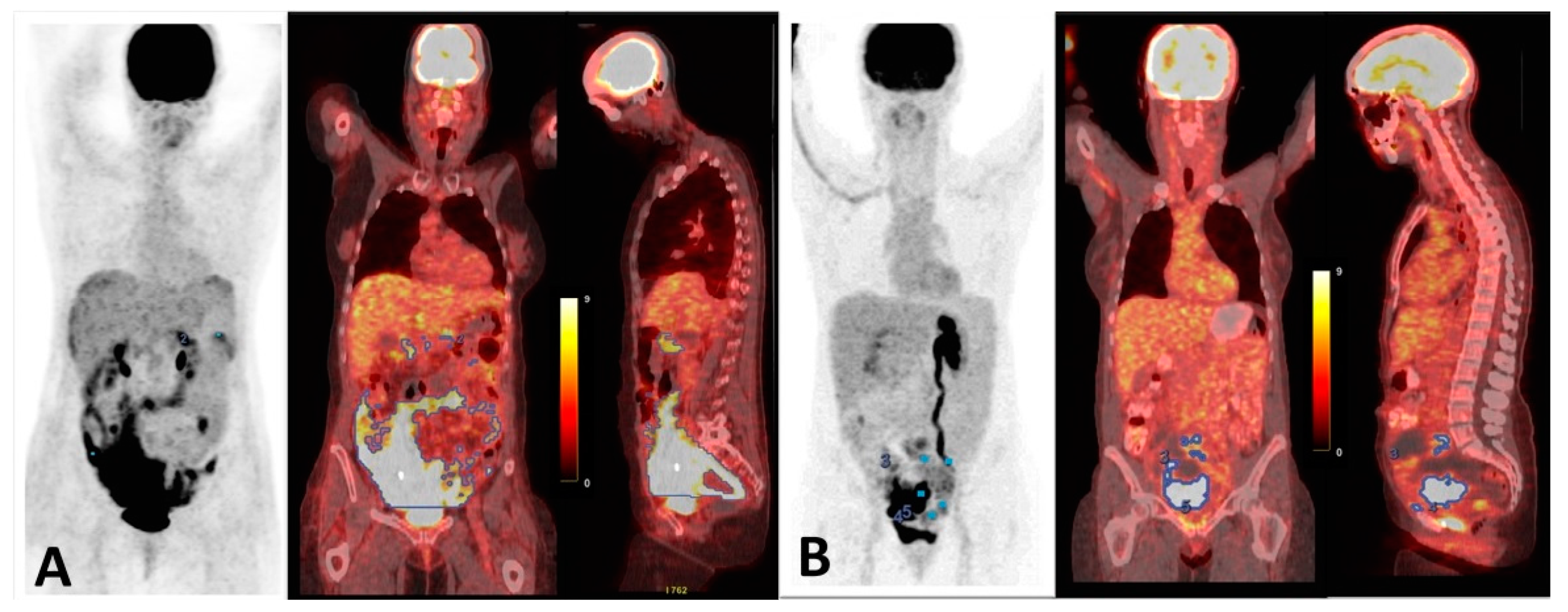 Cancers 17 00698 g005