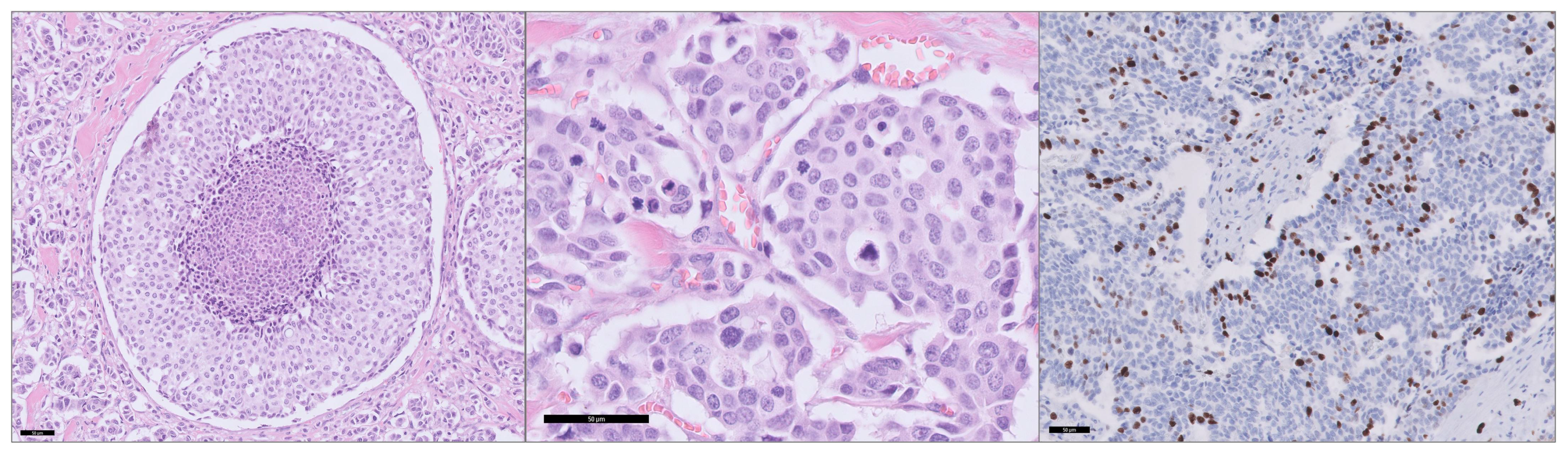 Cancers 17 00737 g001 Cancers 17 00737 g001