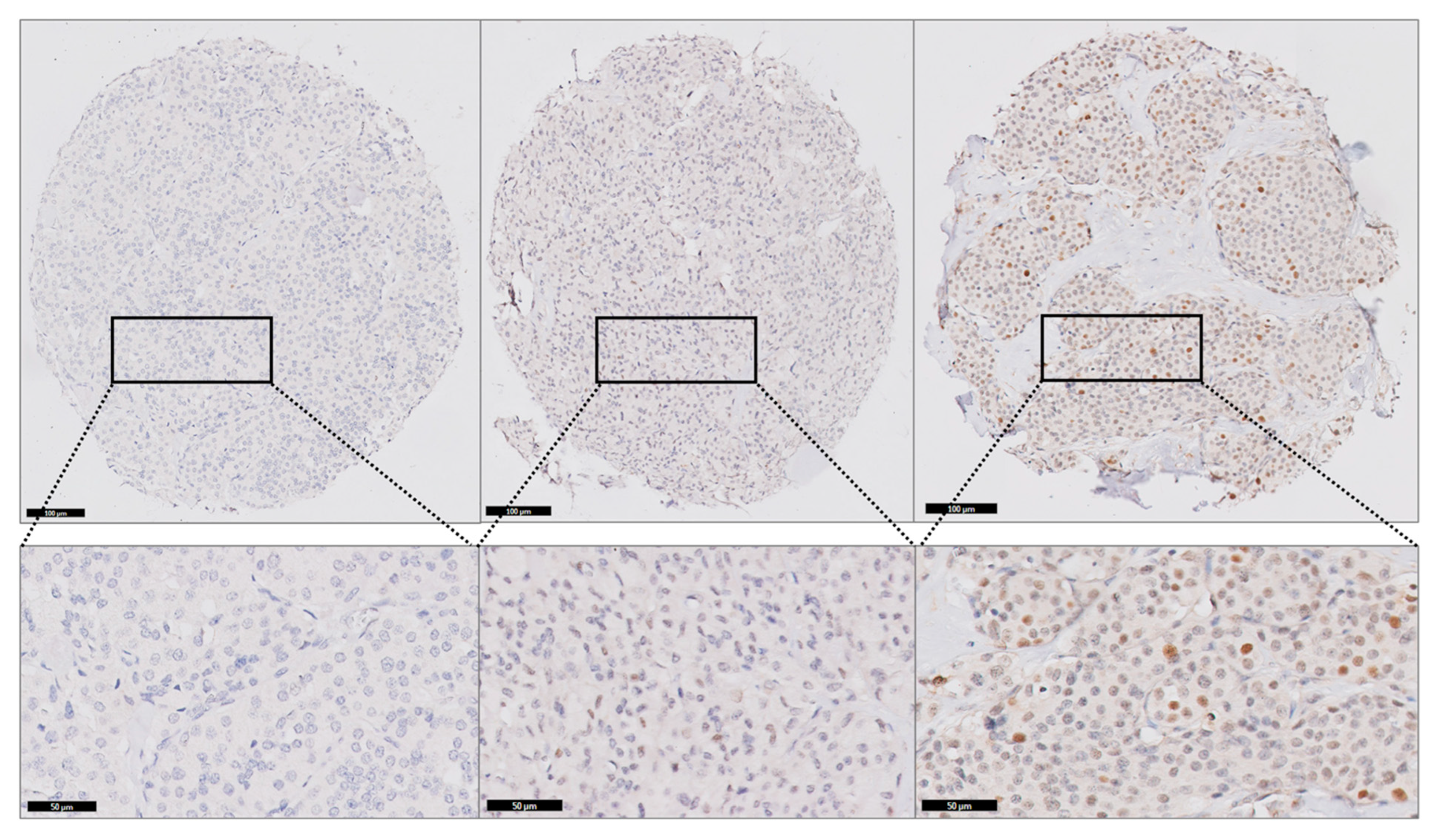 Cancers 17 00737 g002 Cancers 17 00737 g002