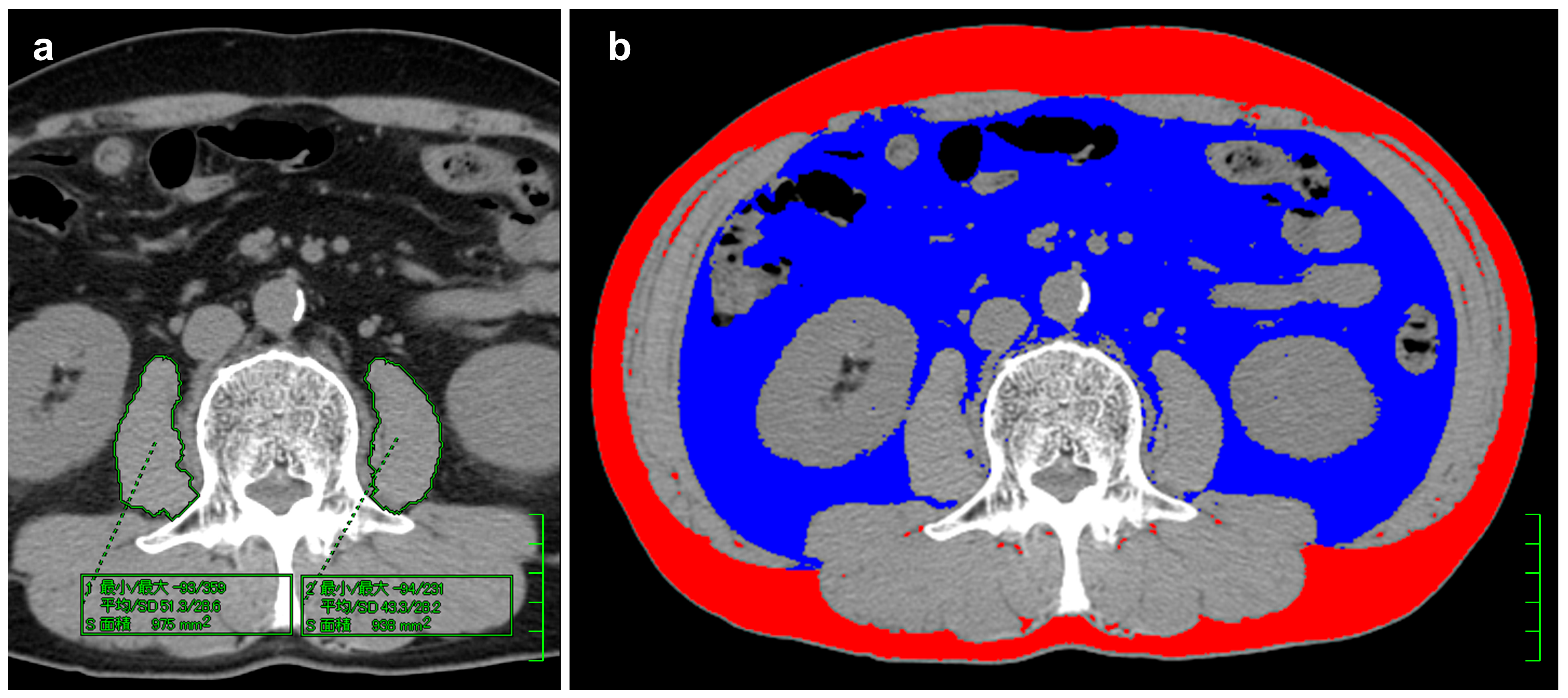 Cancers 17 00738 g001