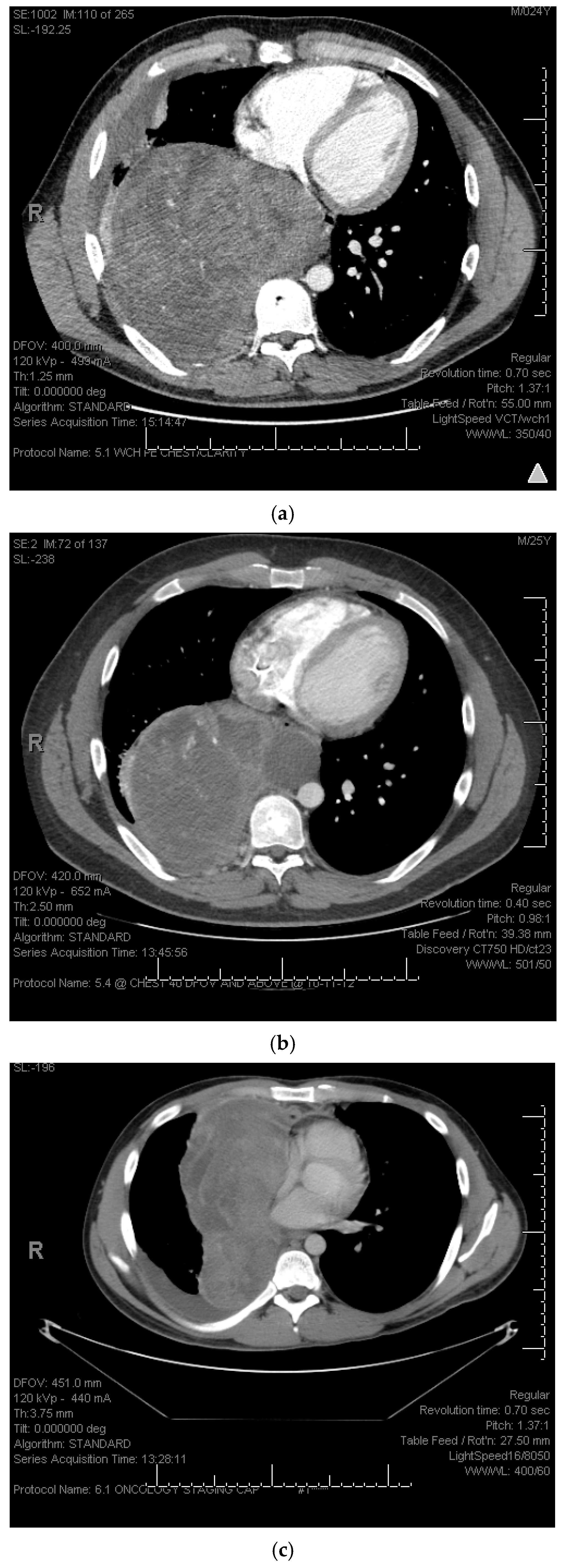 Cancers 17 00745 g004a