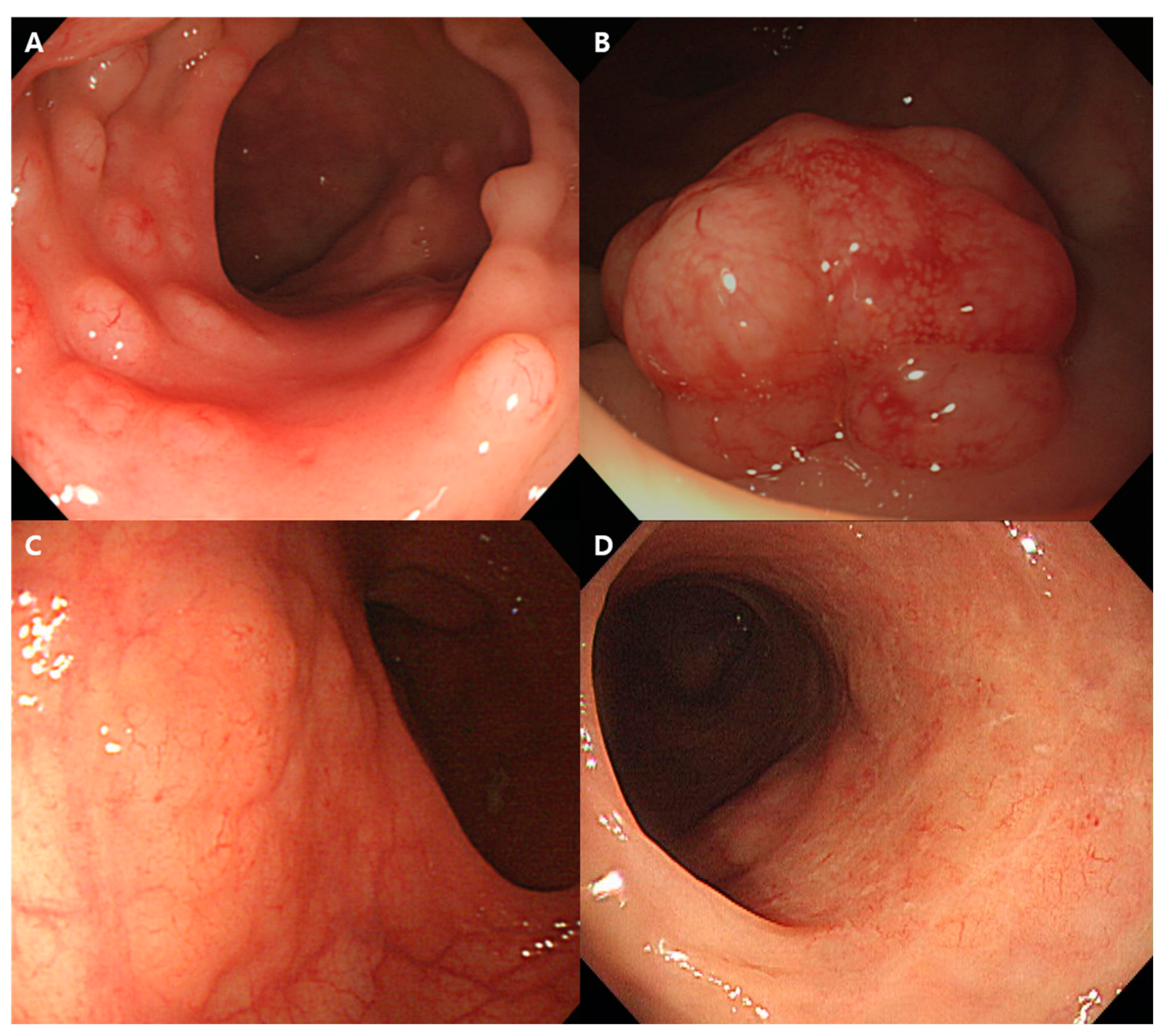 Cancers 17 00750 g001