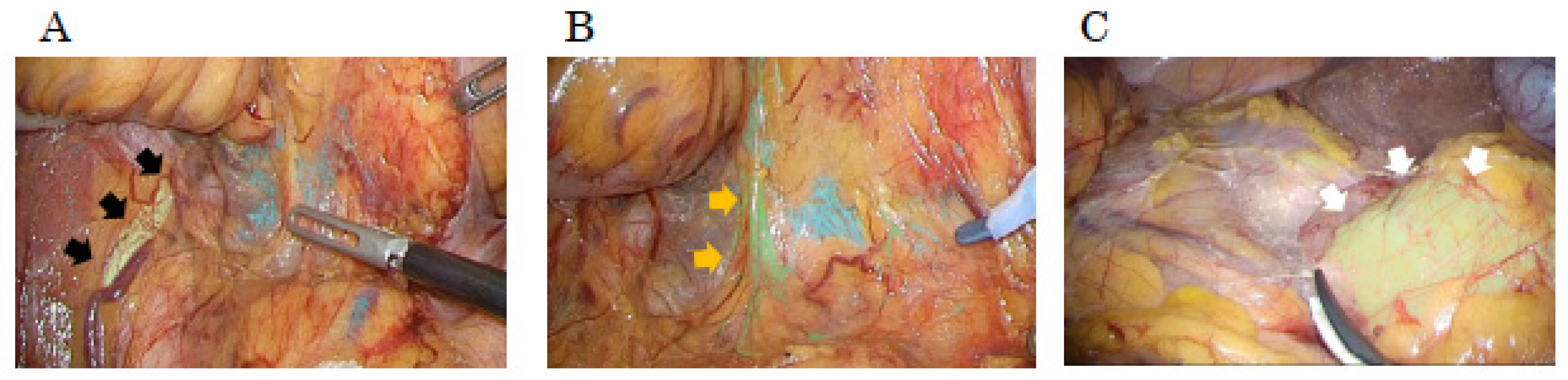 Cancers 17 00761 g001