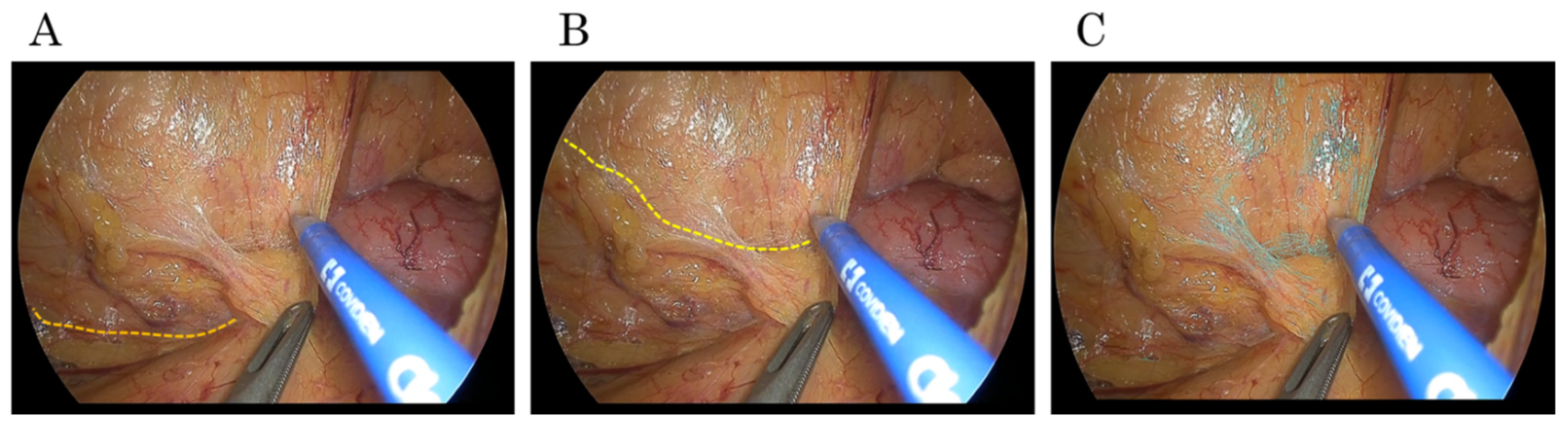 Cancers 17 00761 g002