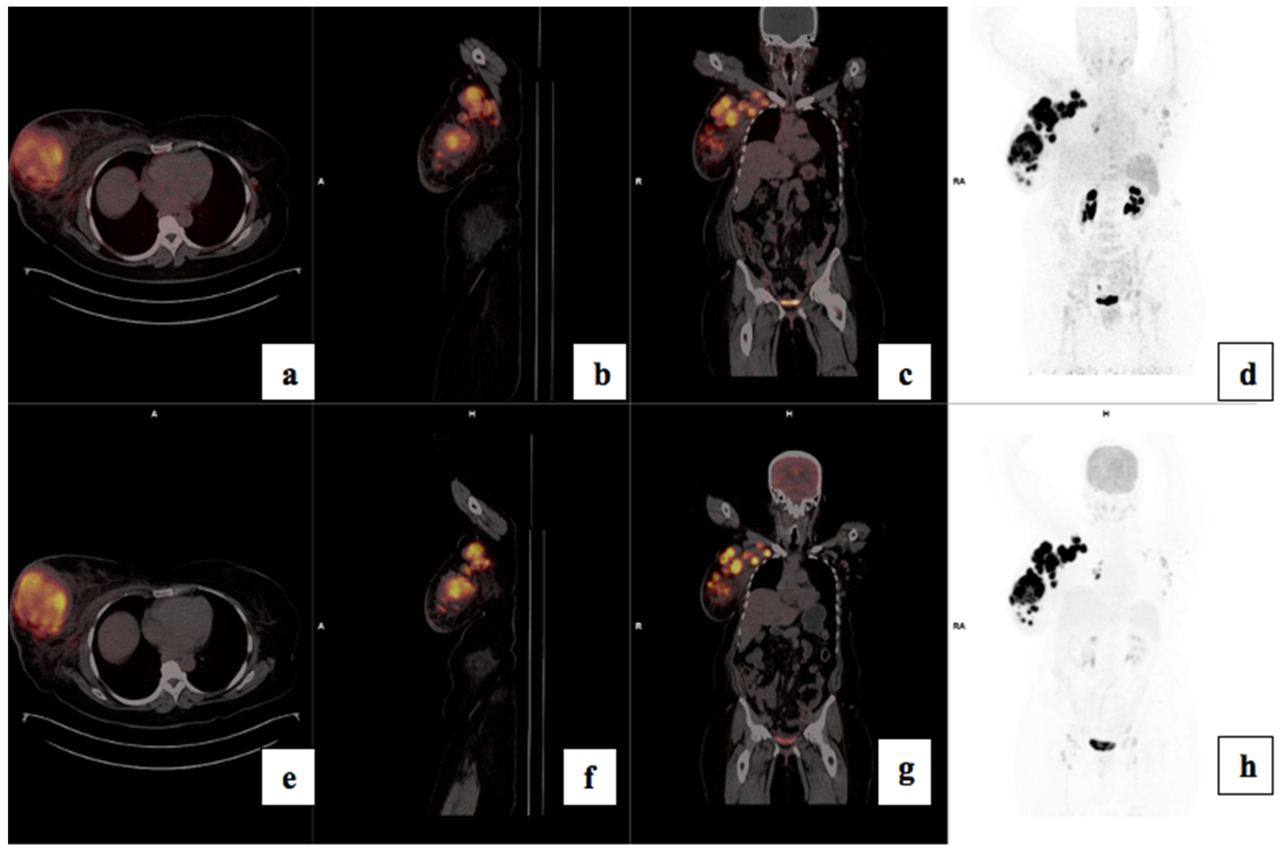 Cancers 17 00763 g003