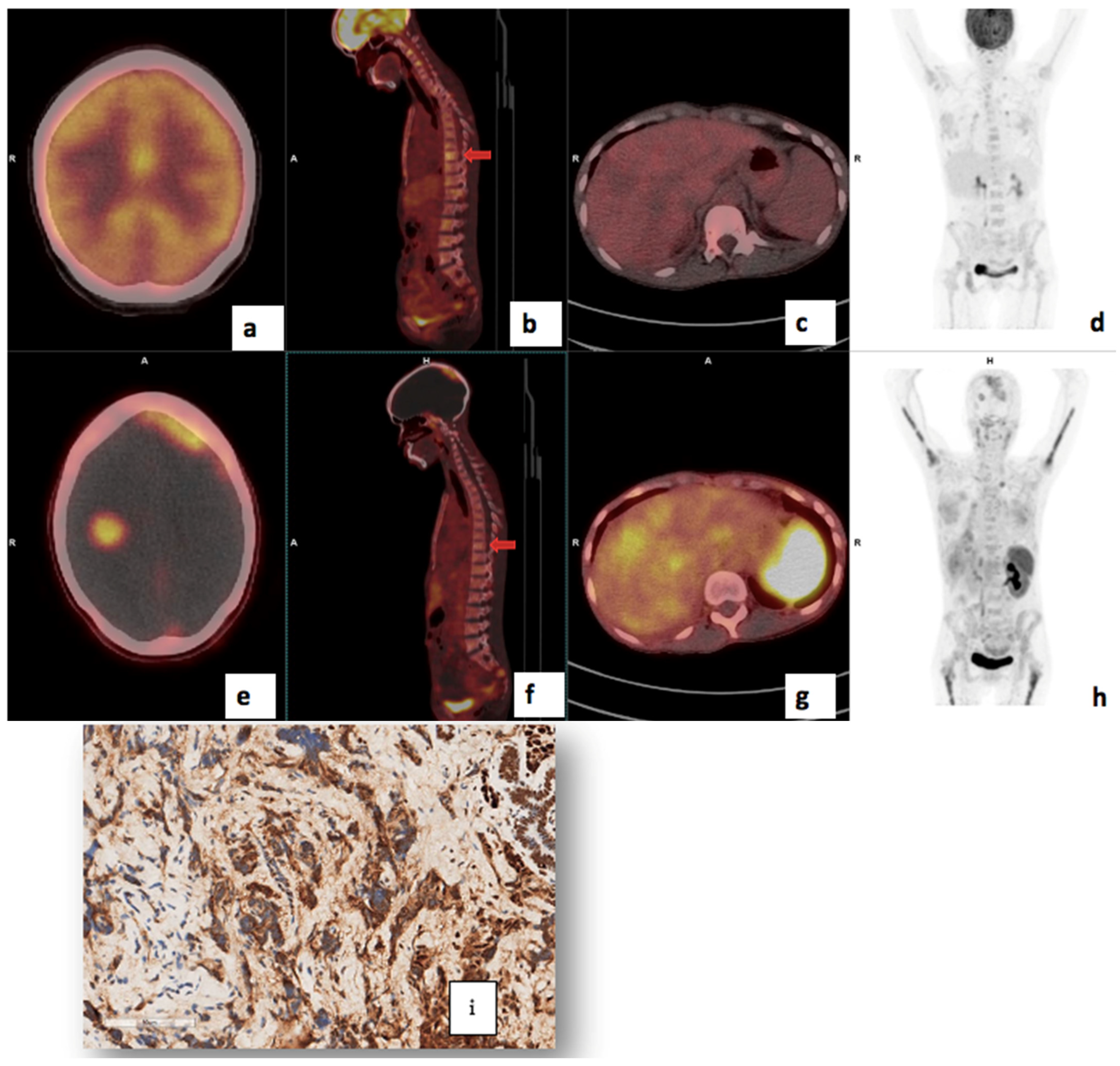Cancers 17 00763 g005
