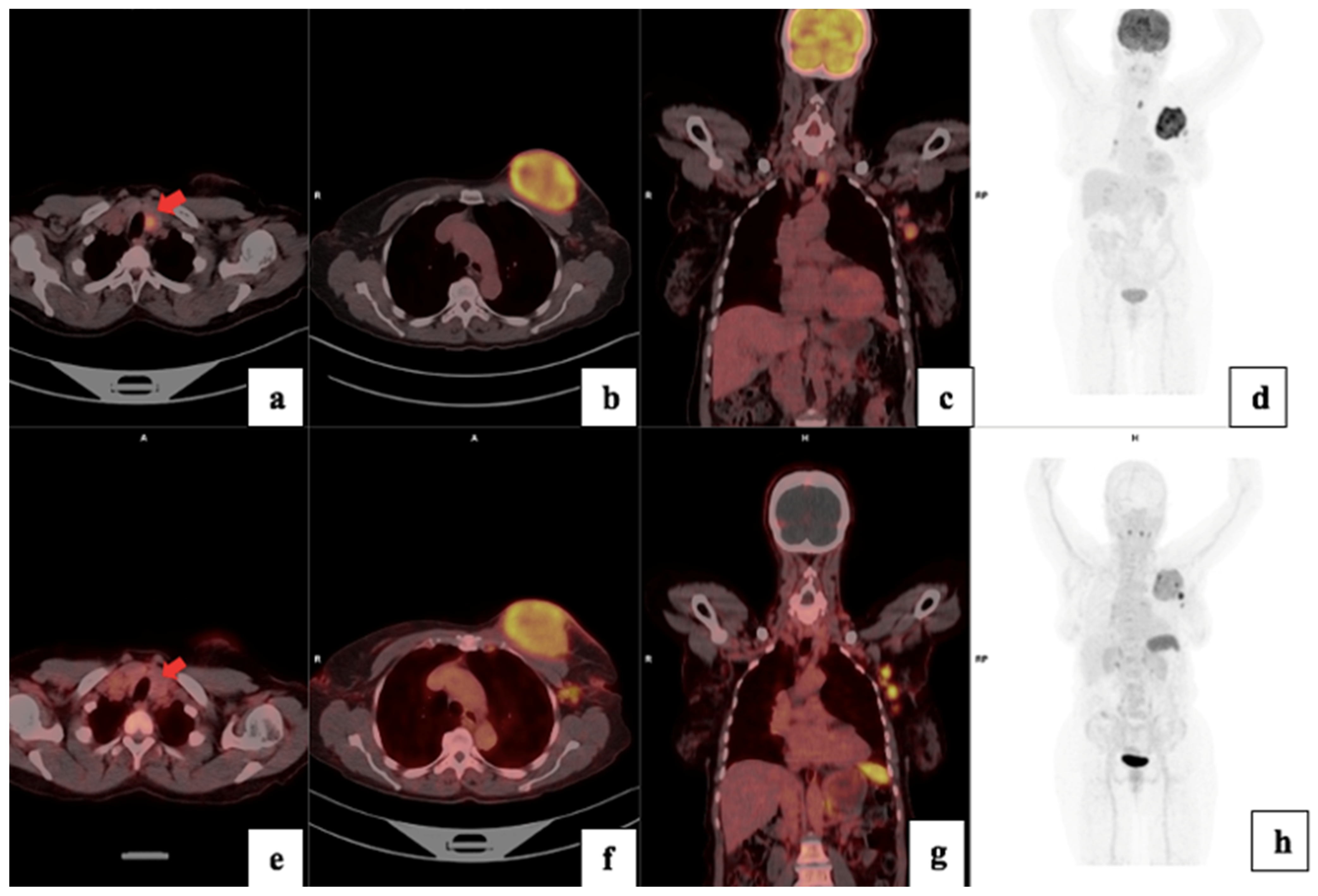Cancers 17 00763 g006