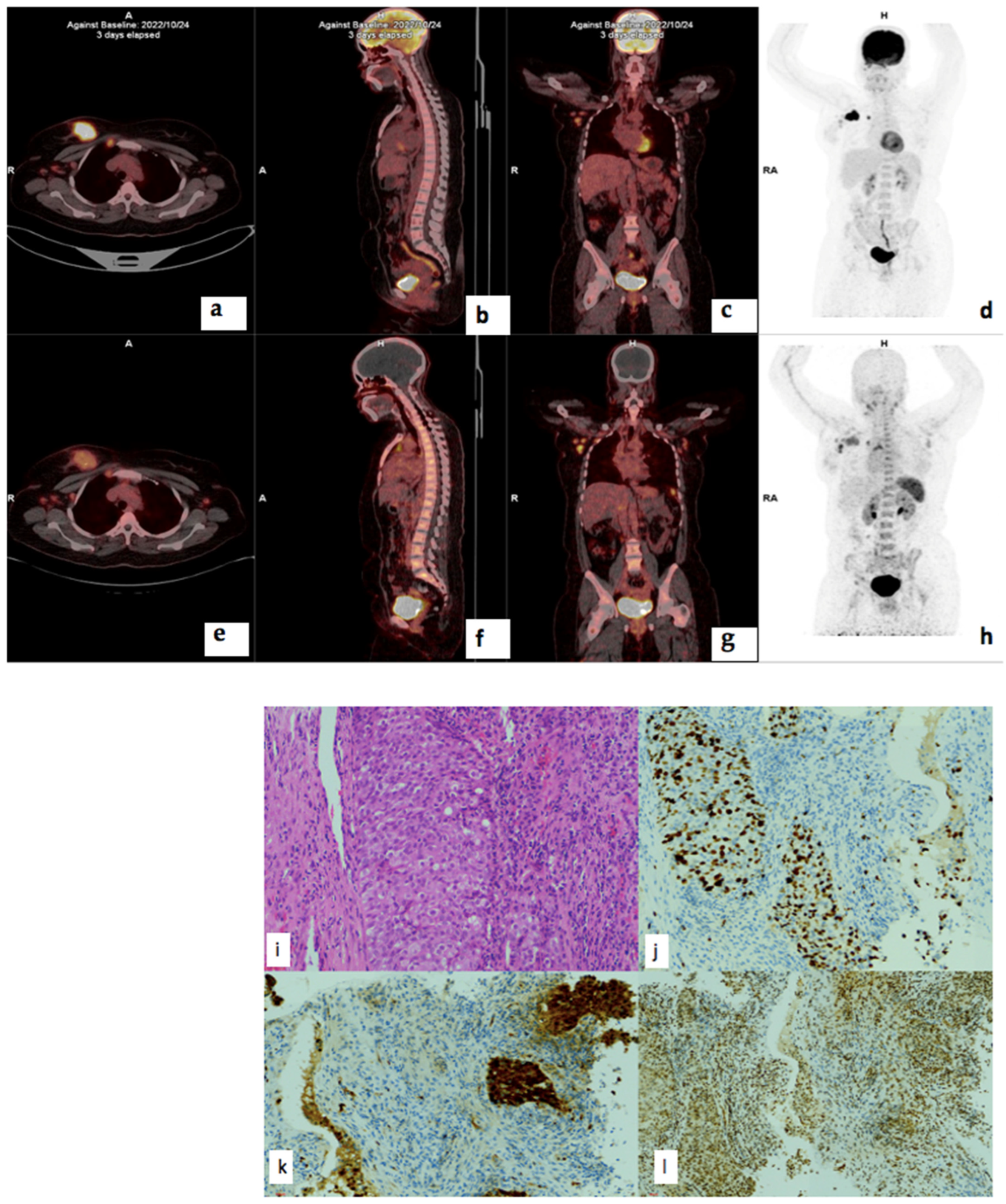 Cancers 17 00763 g008