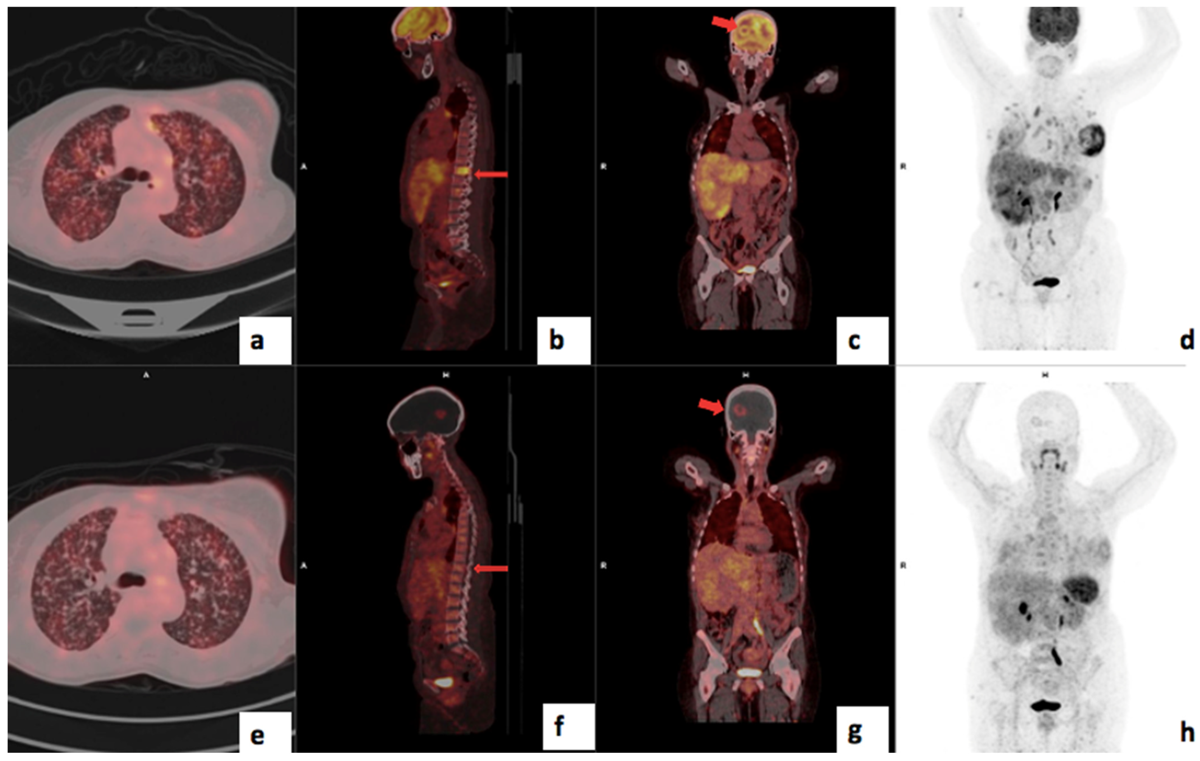 Cancers 17 00763 g009