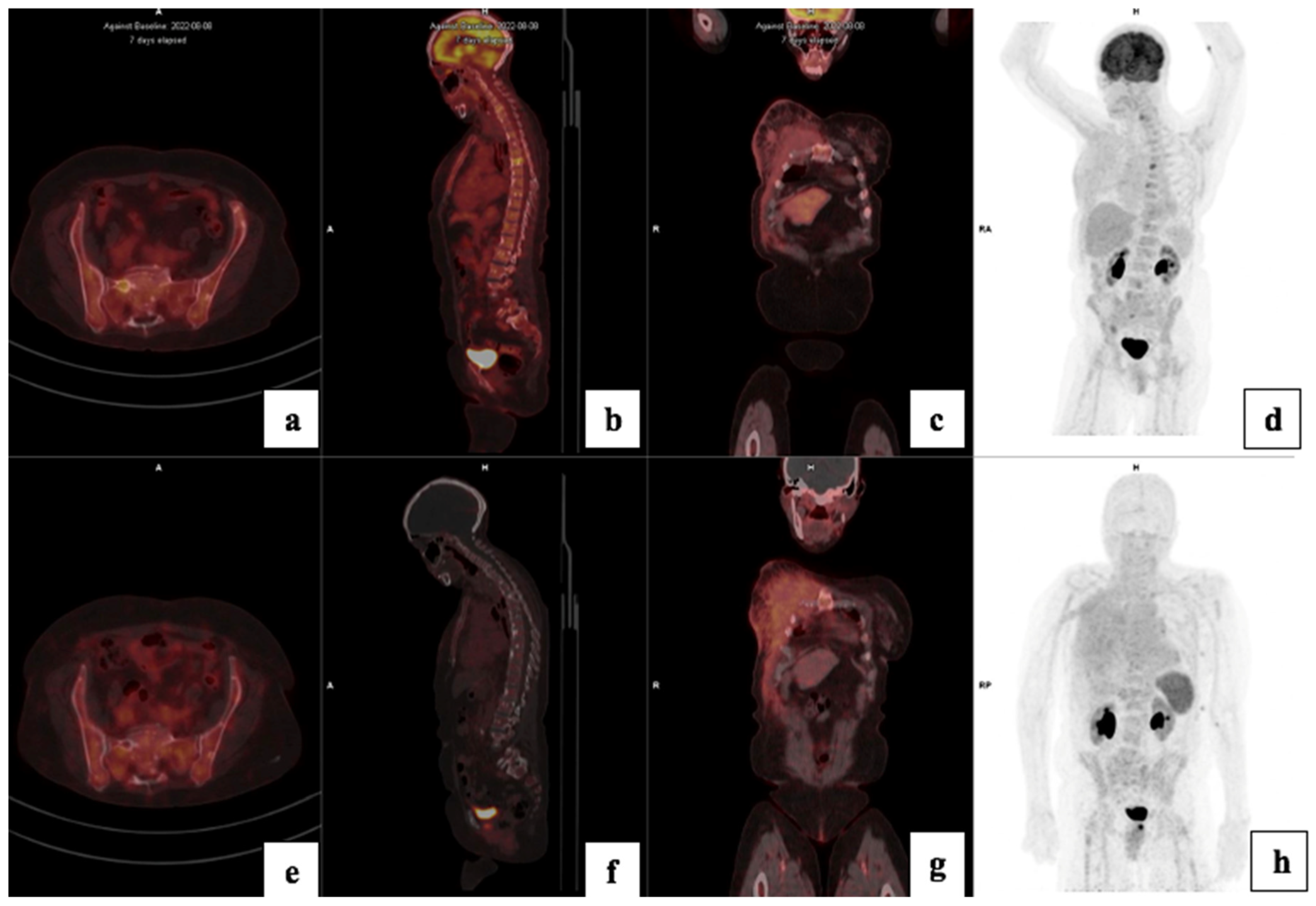 Cancers 17 00763 g010