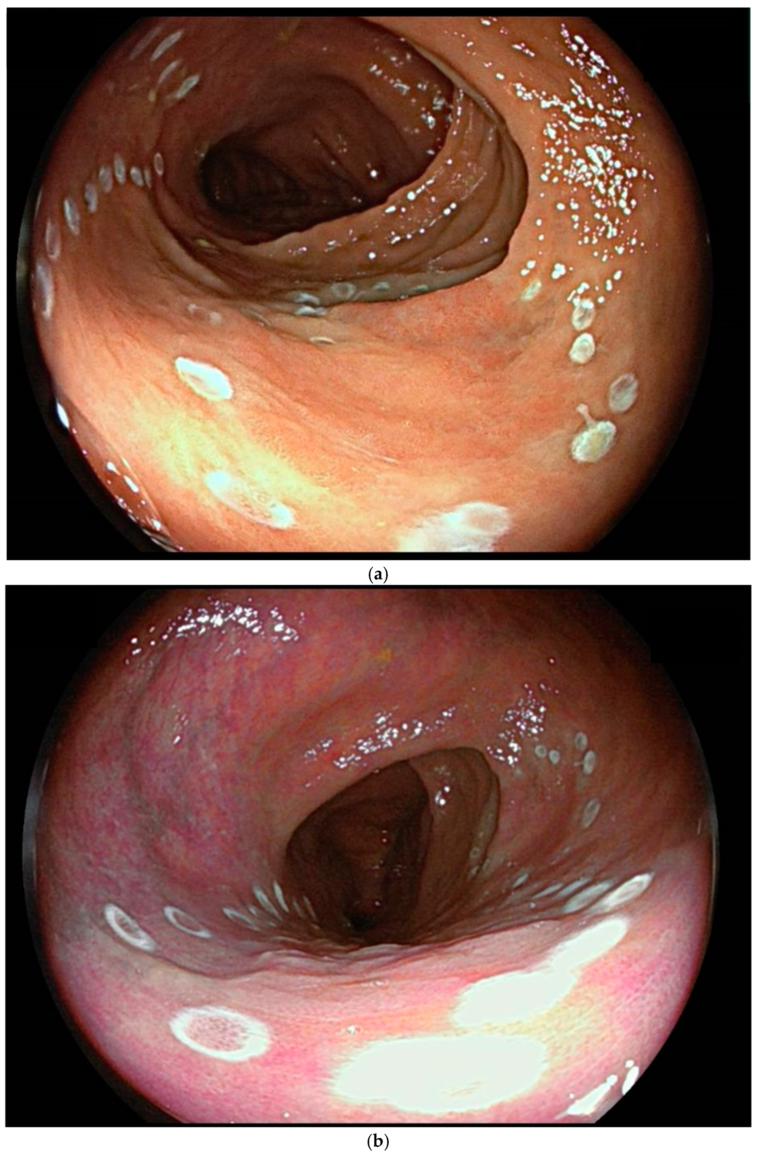 Cancers 17 00784 g001a