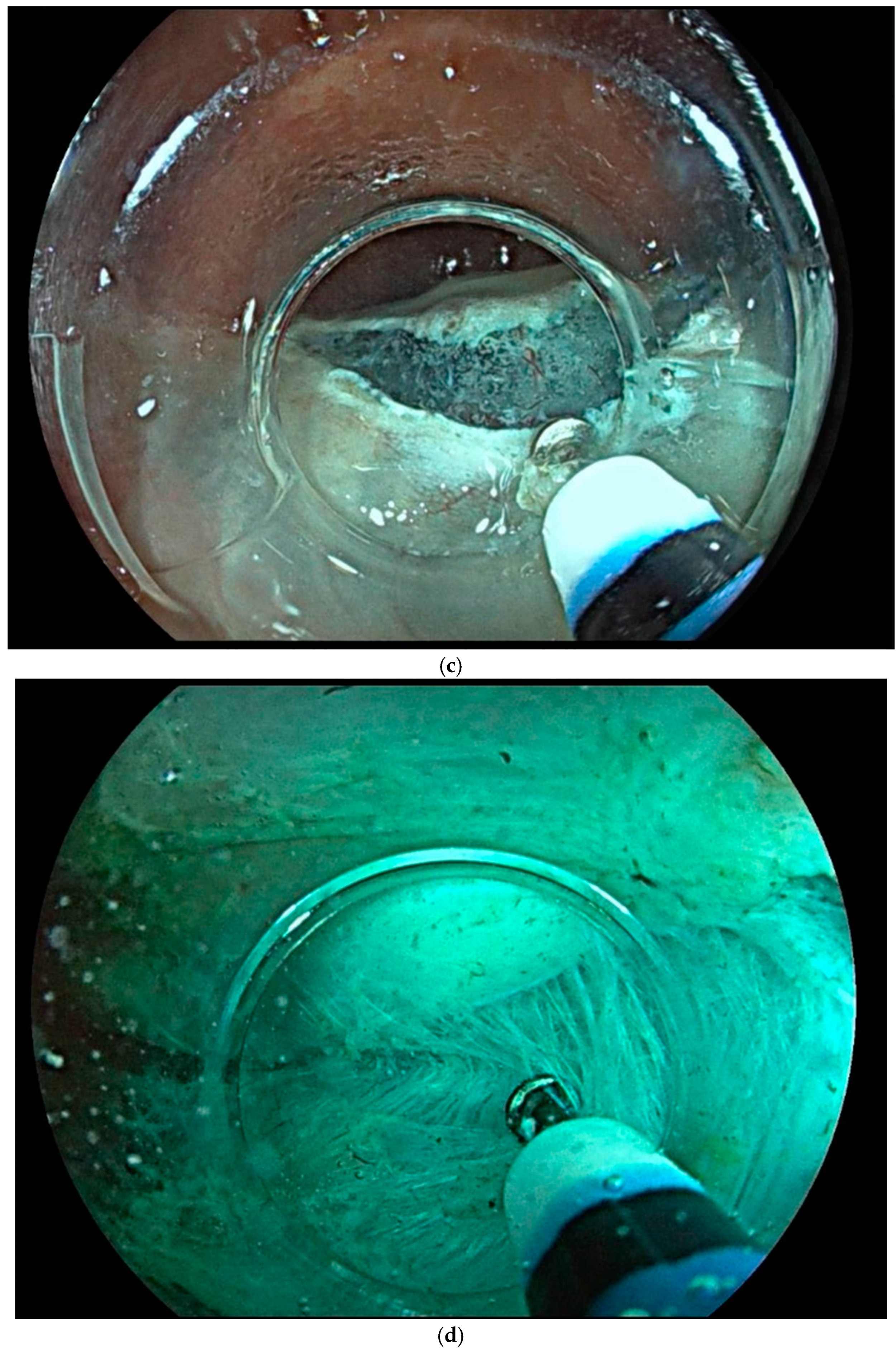 Cancers 17 00784 g001b