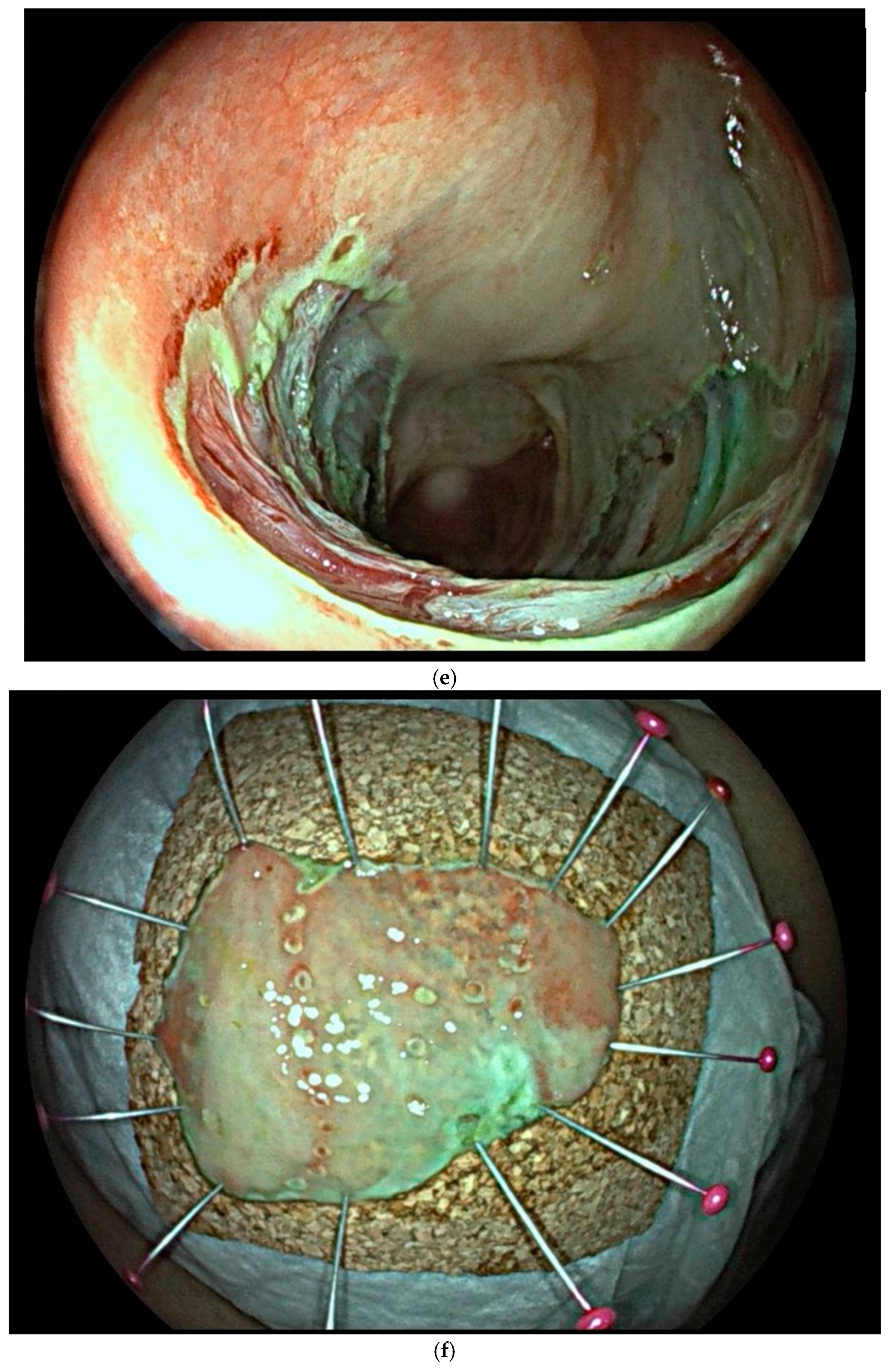 Cancers 17 00784 g001c