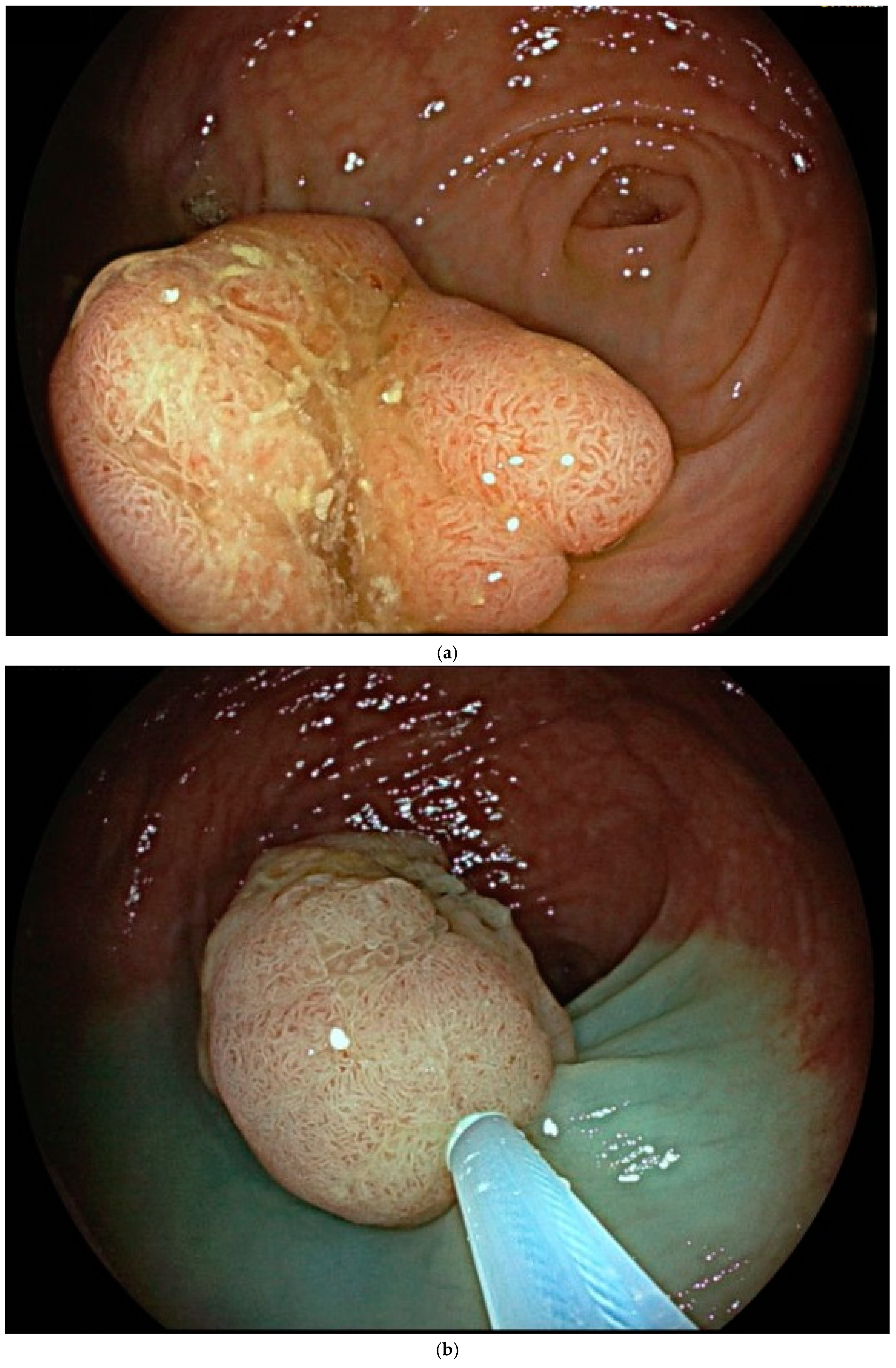 Cancers 17 00784 g002a