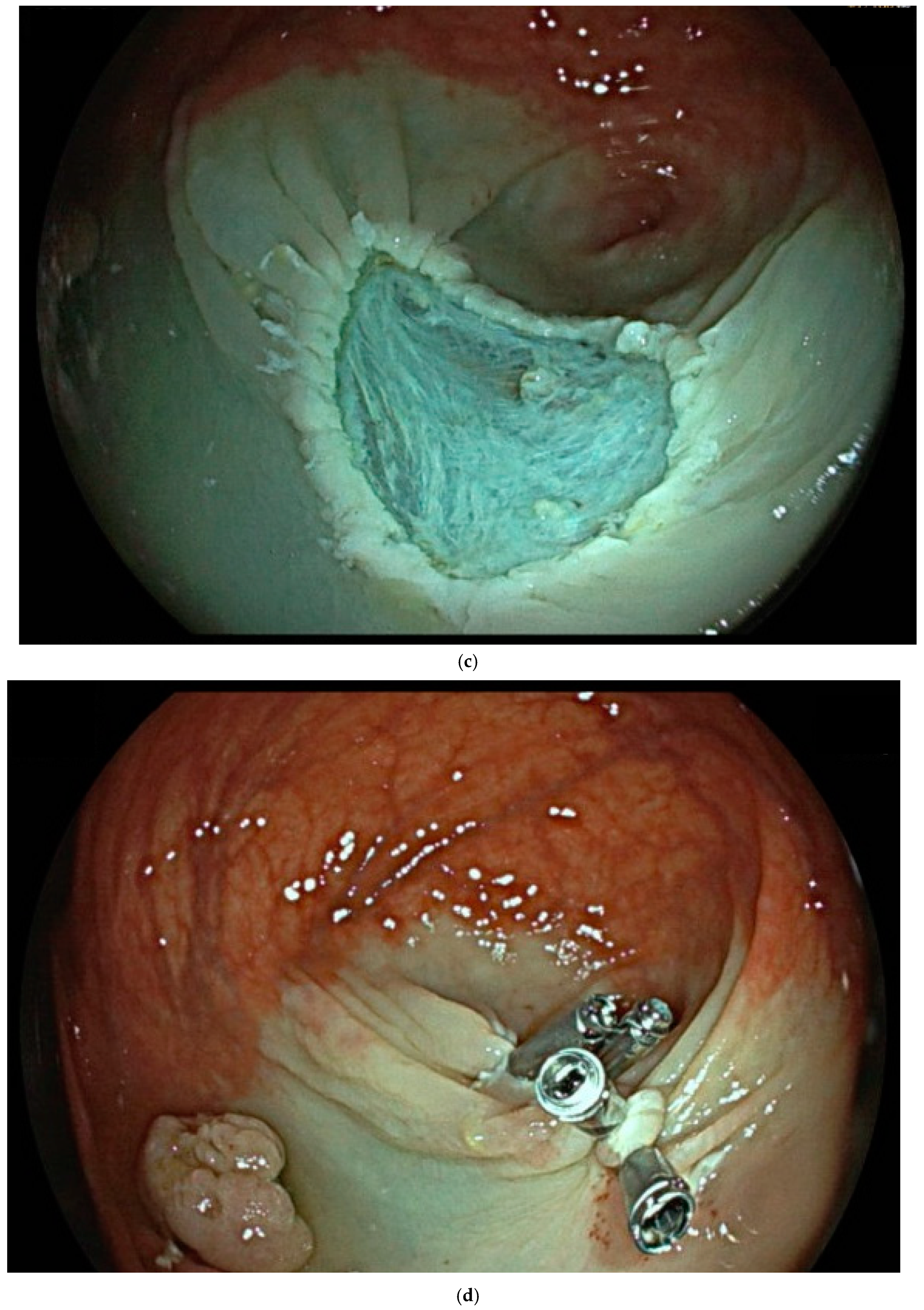 Cancers 17 00784 g002b
