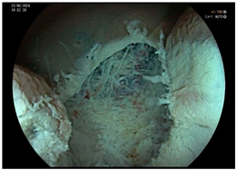 Cancers 17 00784 i001