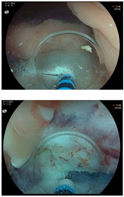 Cancers 17 00784 i002