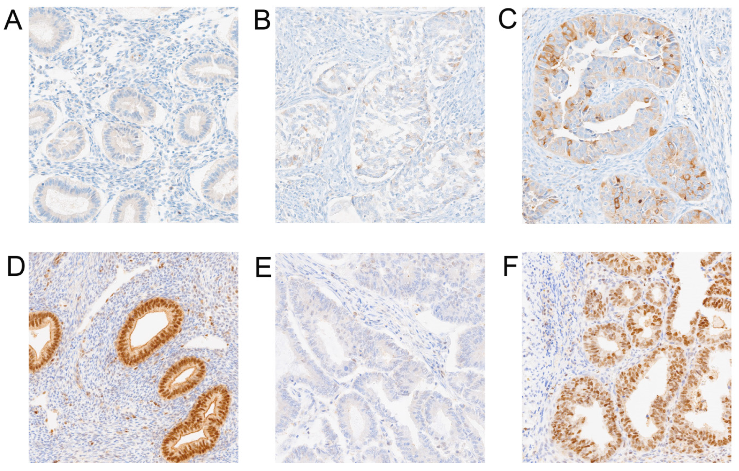 Cancers 17 00804 g001 Cancers 17 00804 g001