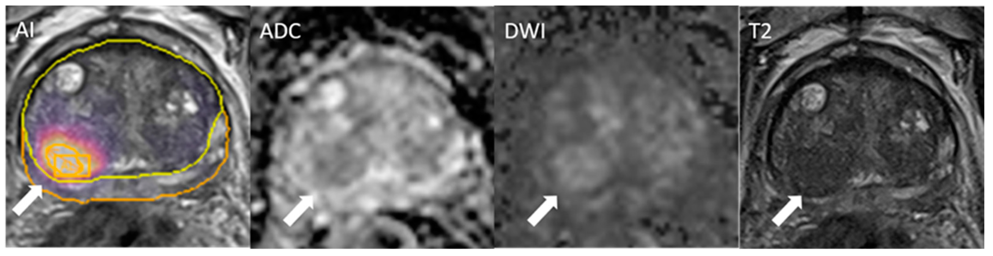 Cancers 17 00815 g004