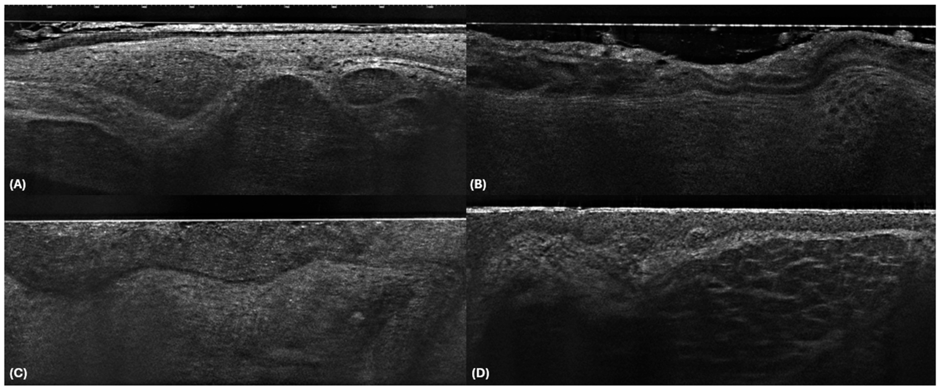 Cancers 17 00826 g001