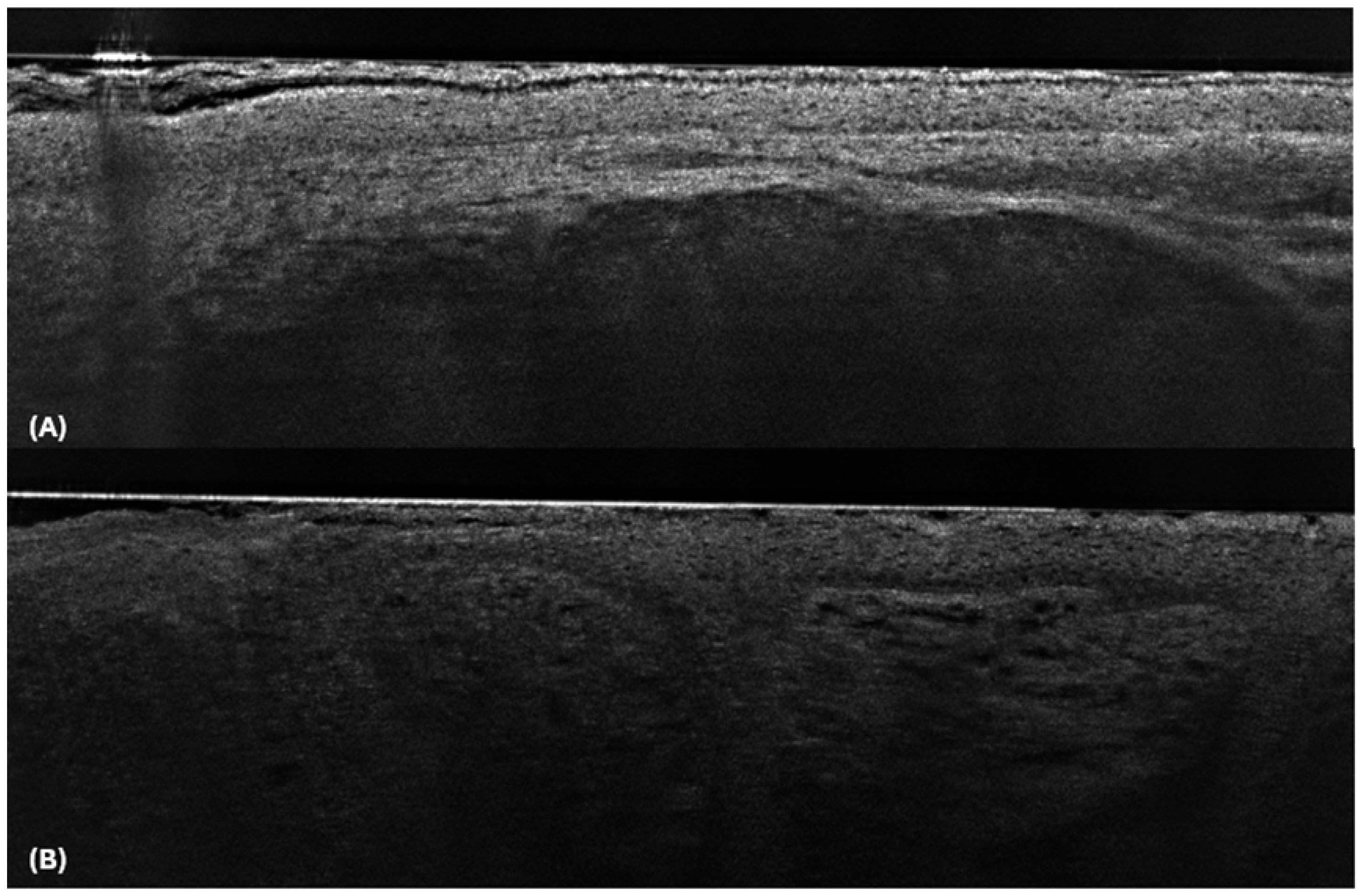 Cancers 17 00826 g003