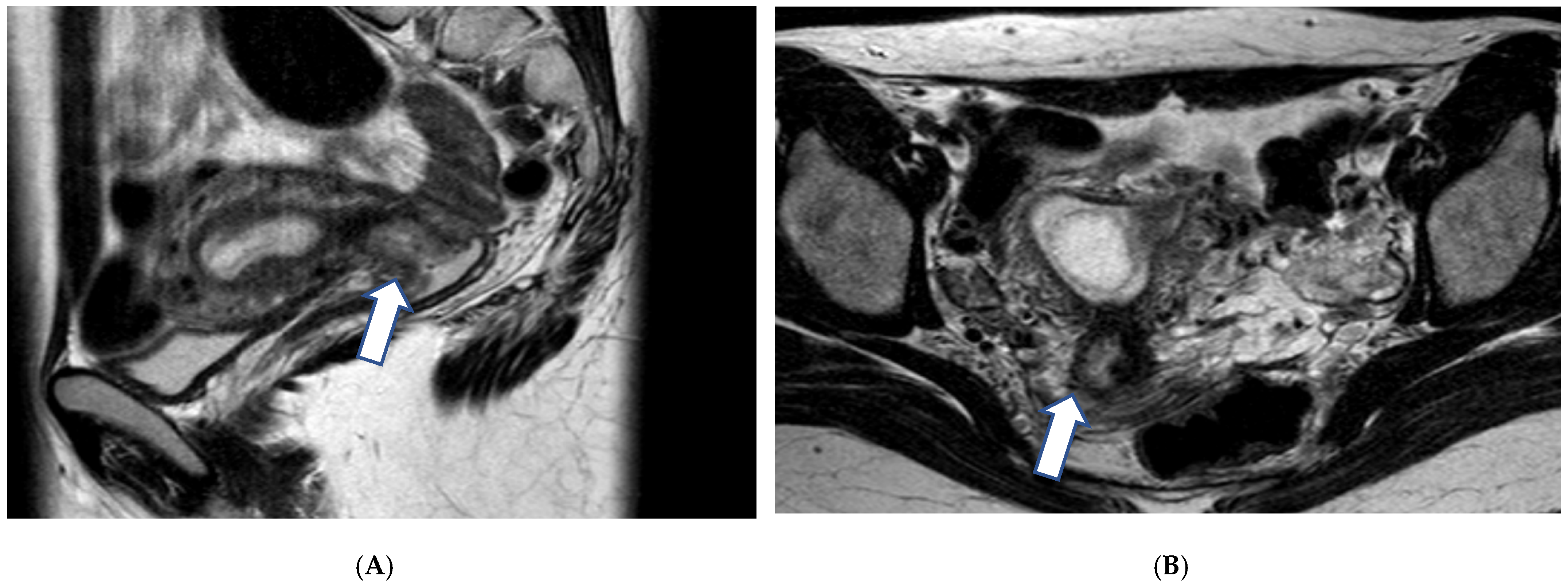 Cancers 17 00838 g001