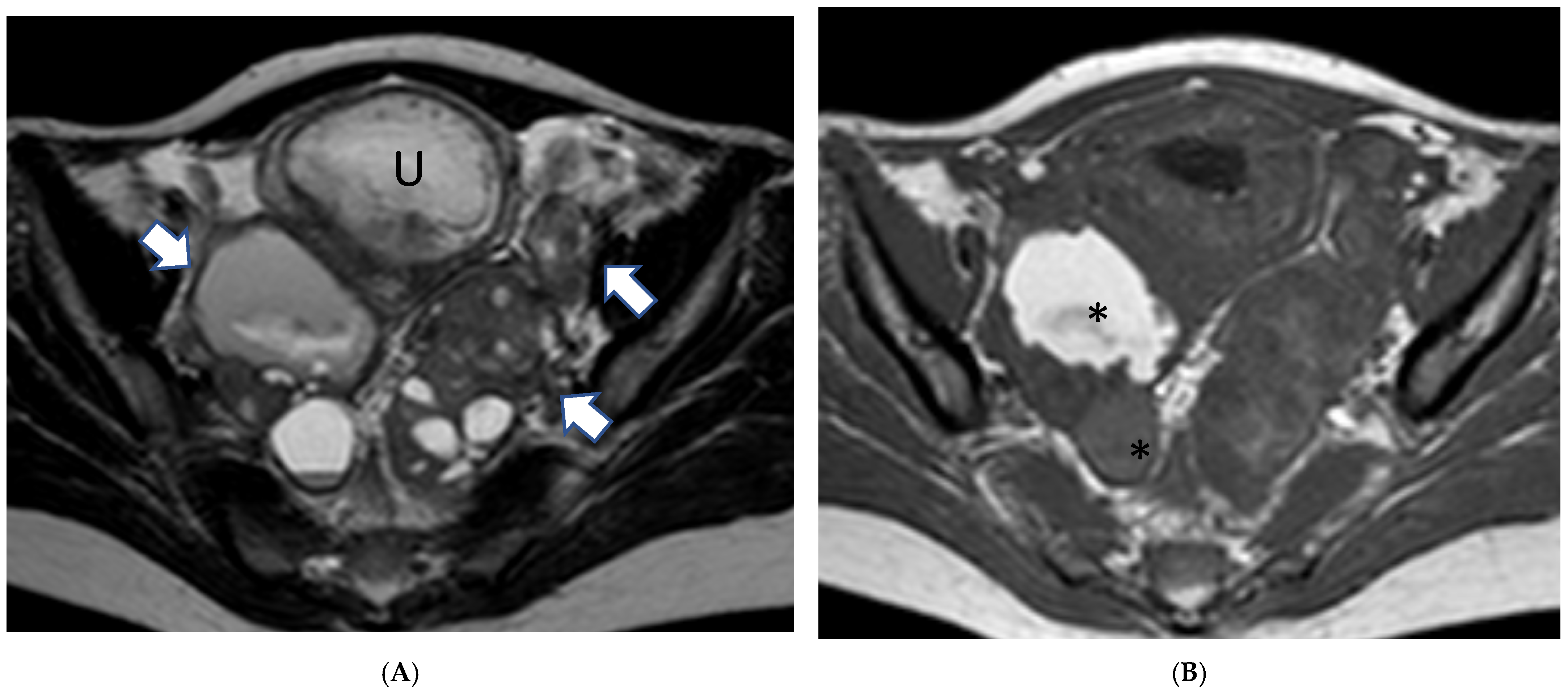 Cancers 17 00838 g002