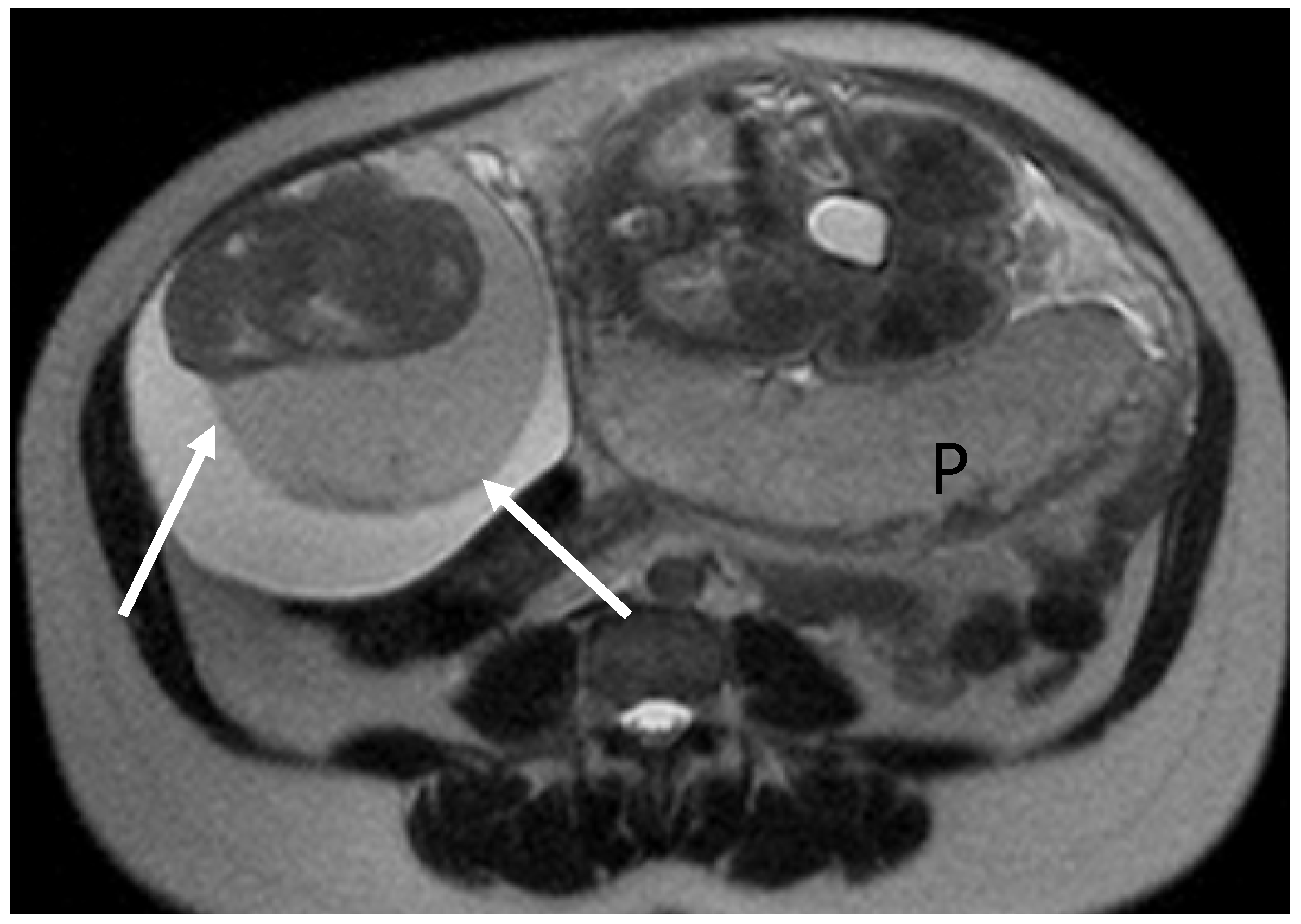 Cancers 17 00838 g003