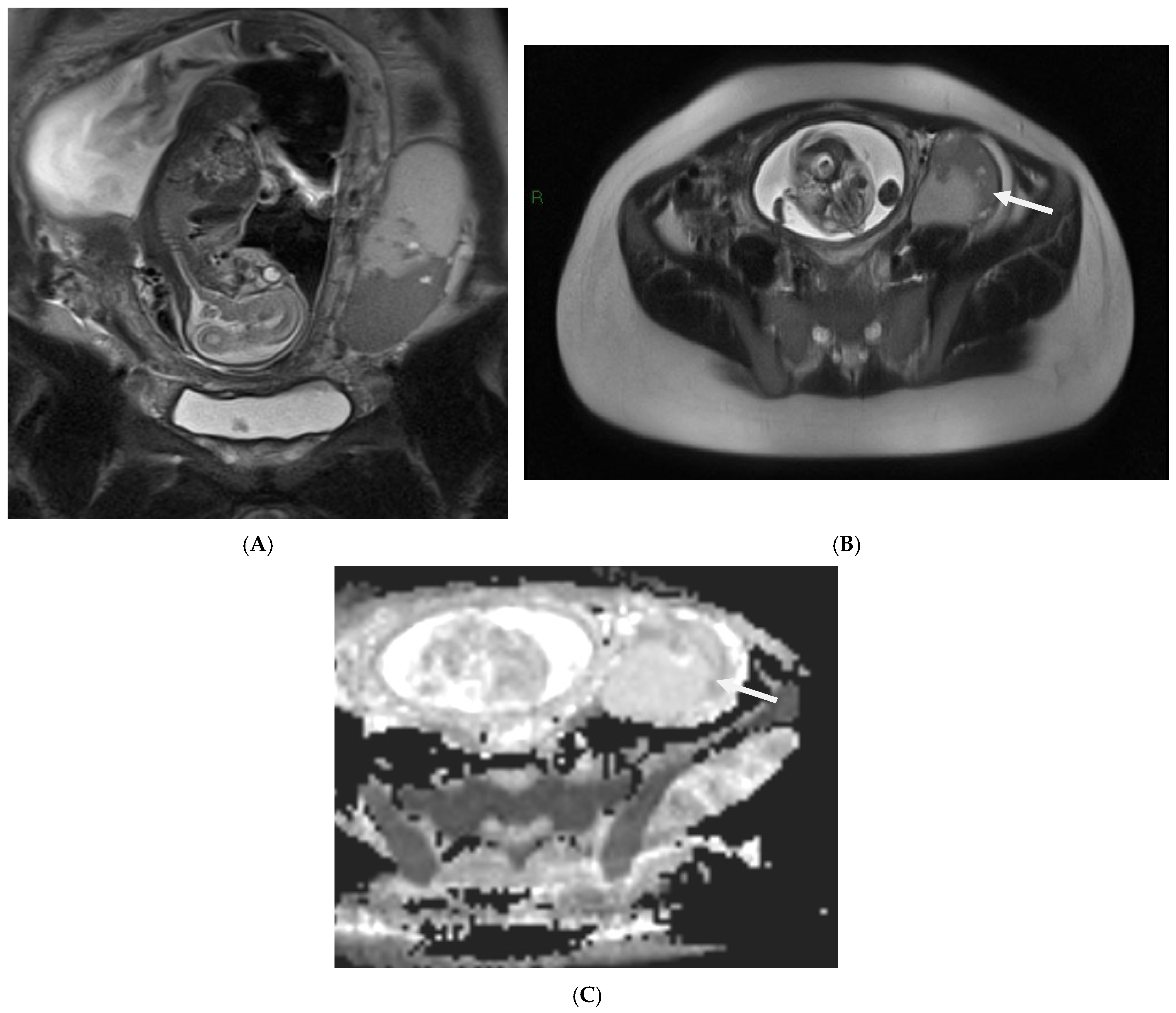 Cancers 17 00838 g004