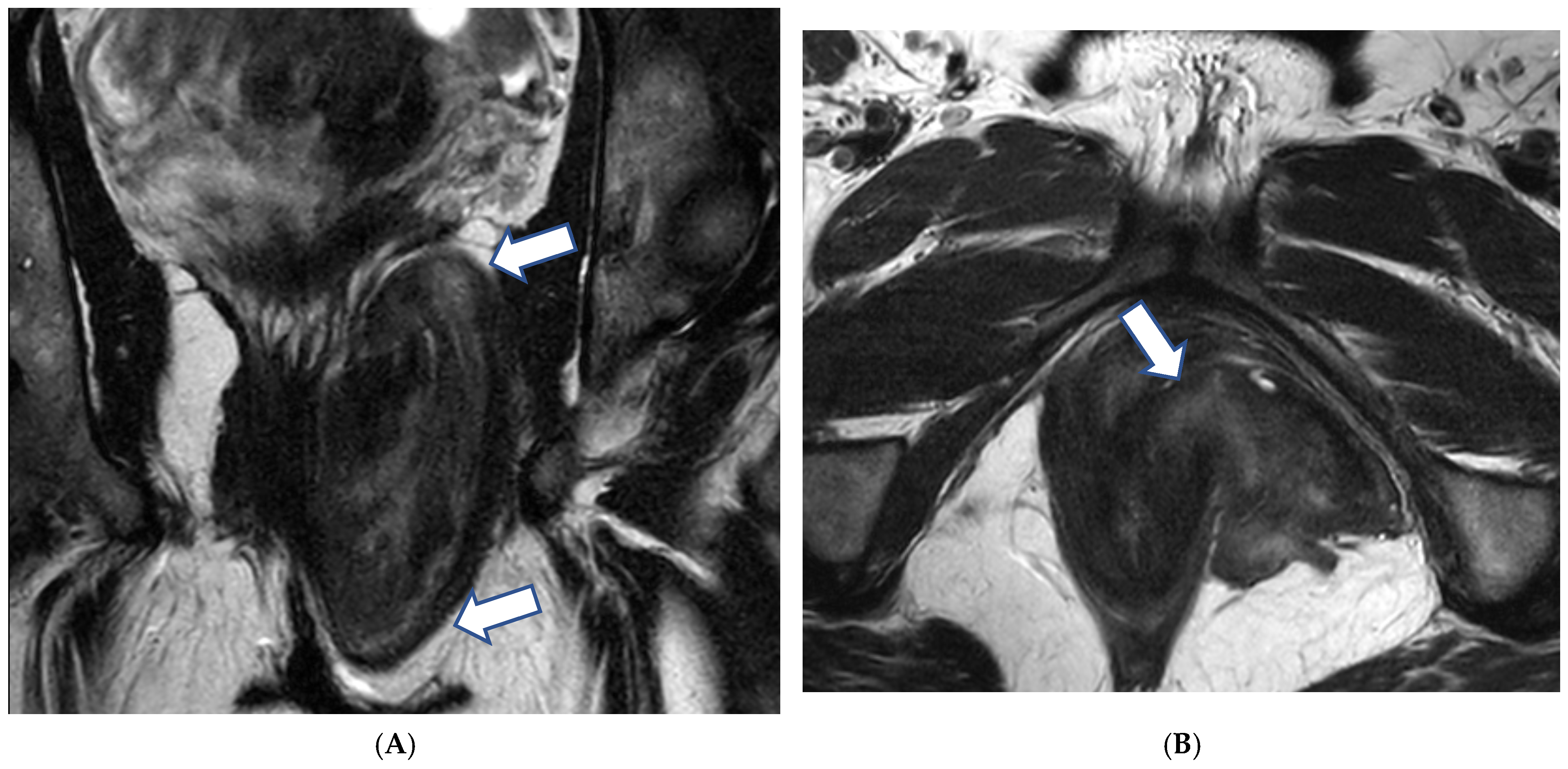 Cancers 17 00838 g006