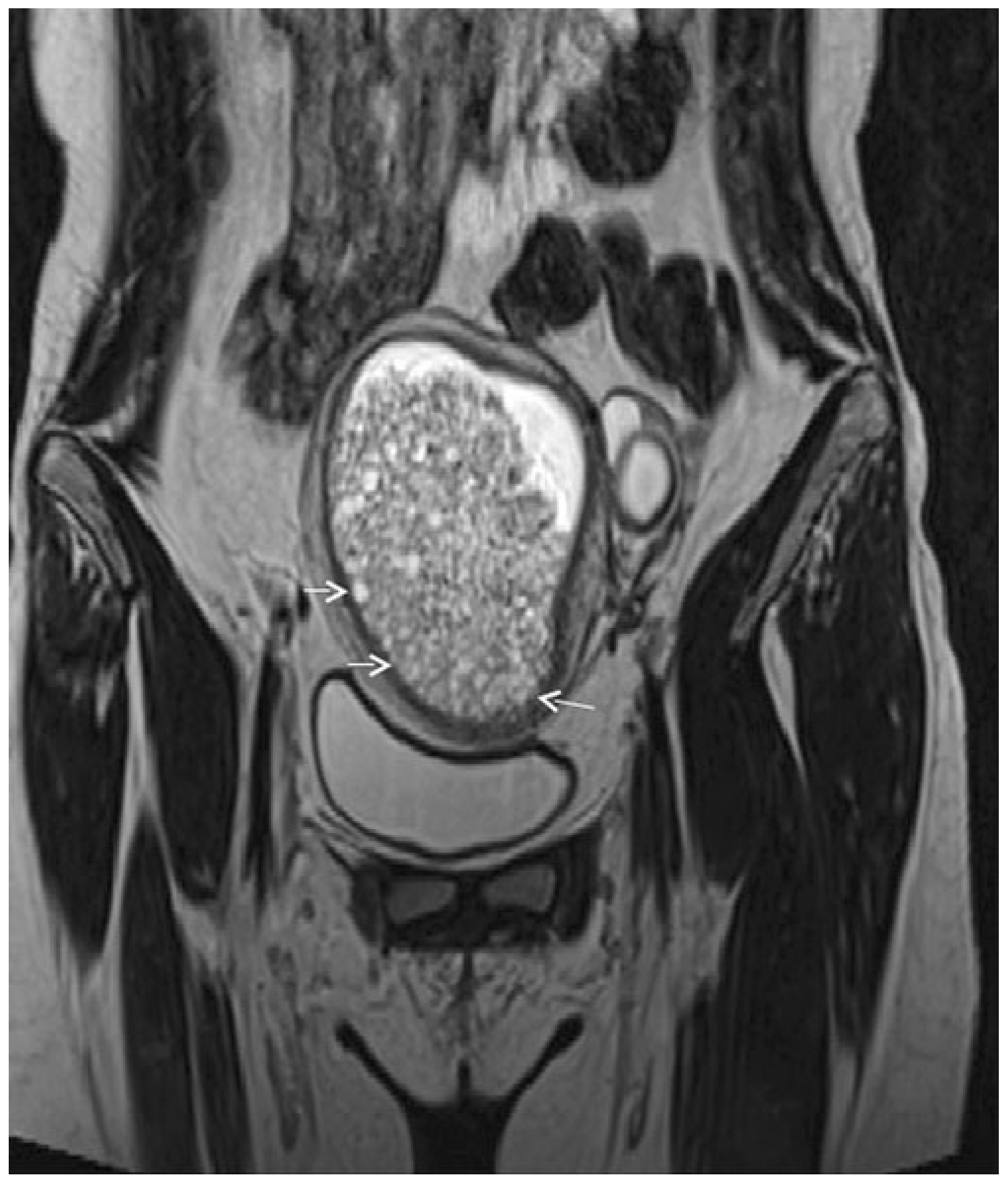 Cancers 17 00838 g007