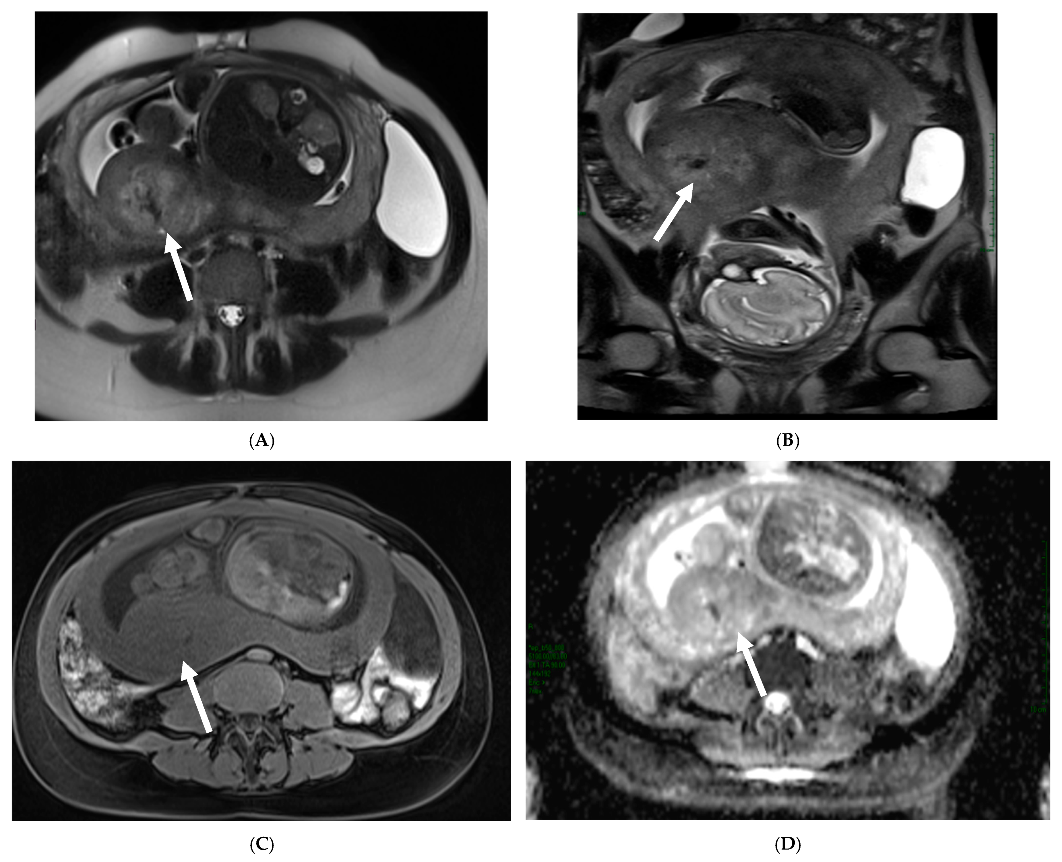 Cancers 17 00838 g008