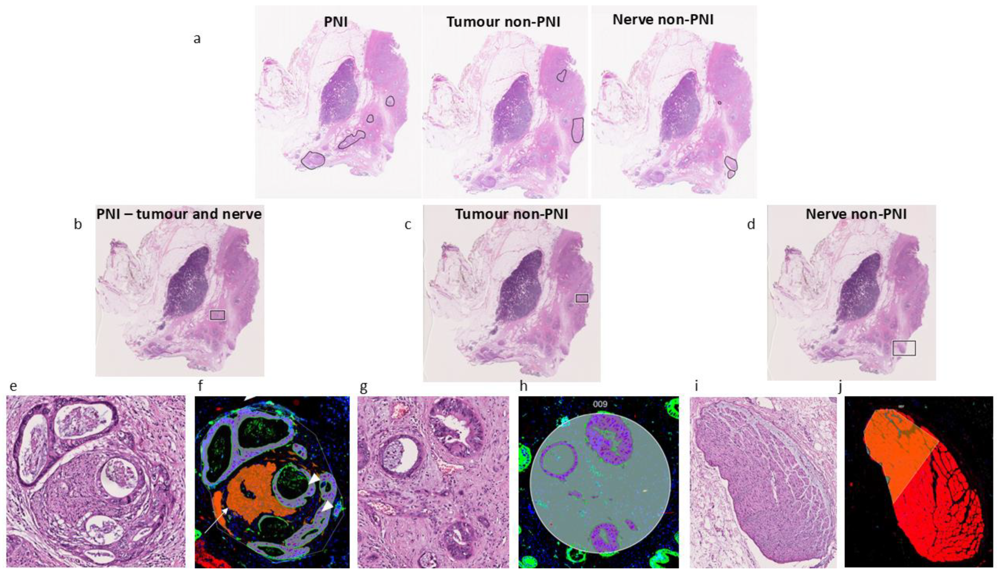 Cancers 17 00852 g001