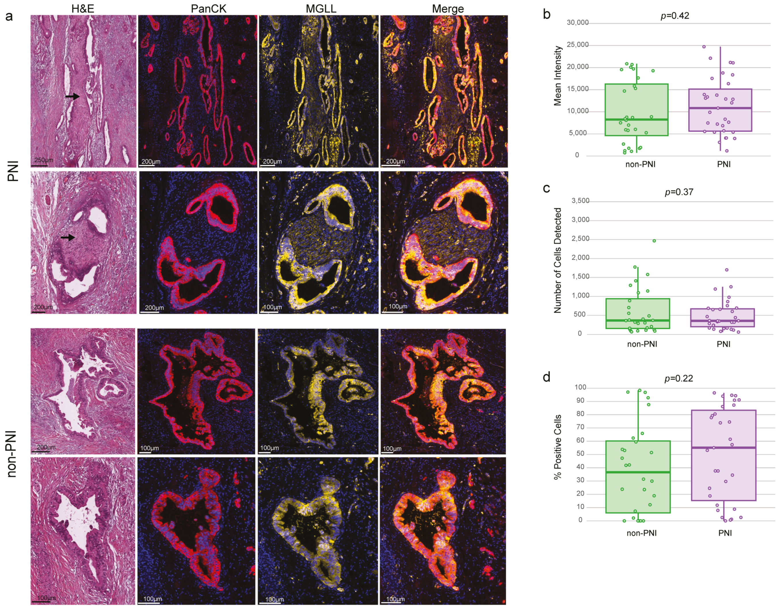 Cancers 17 00852 g004