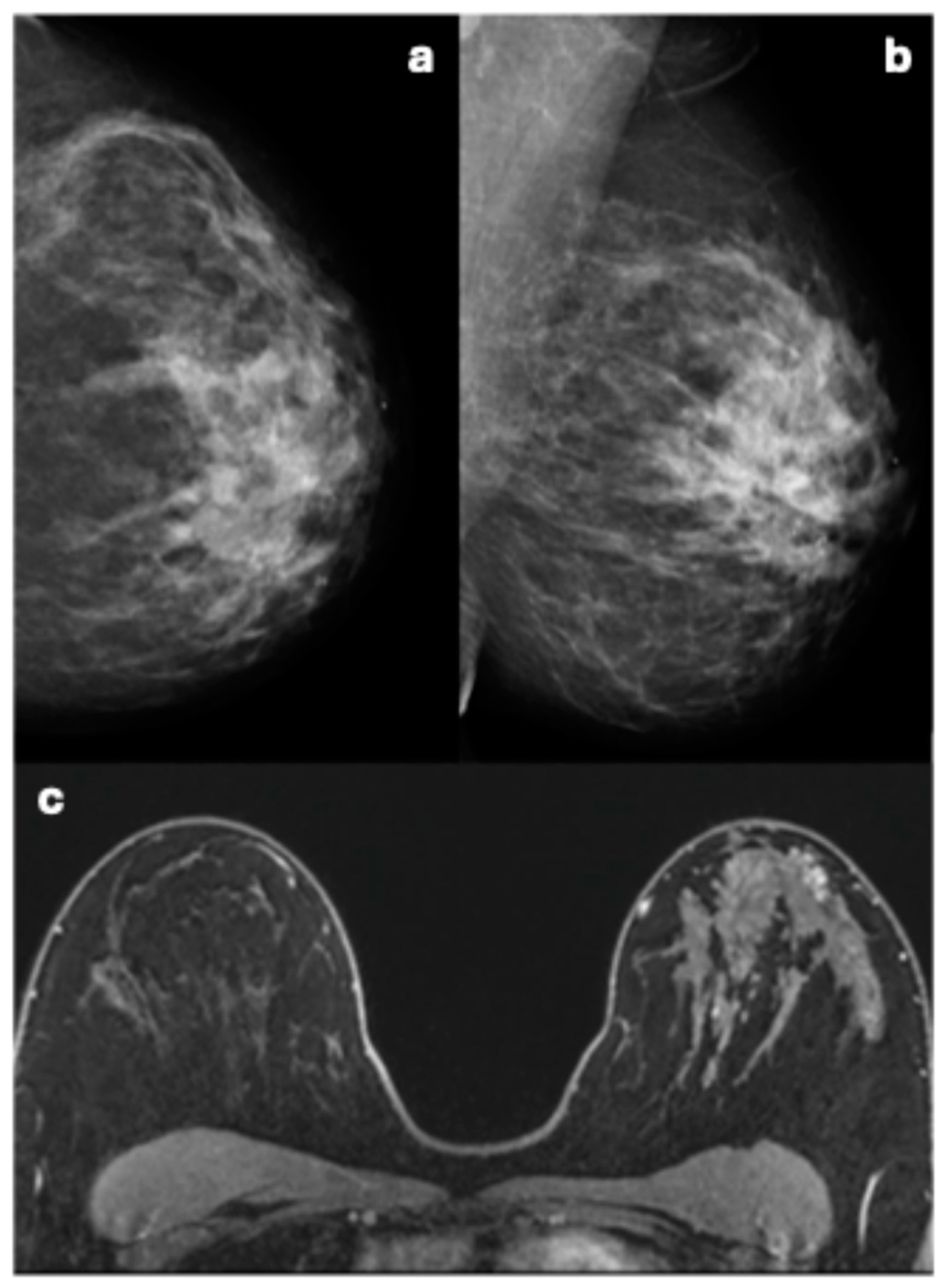 Cancers 17 00856 g006