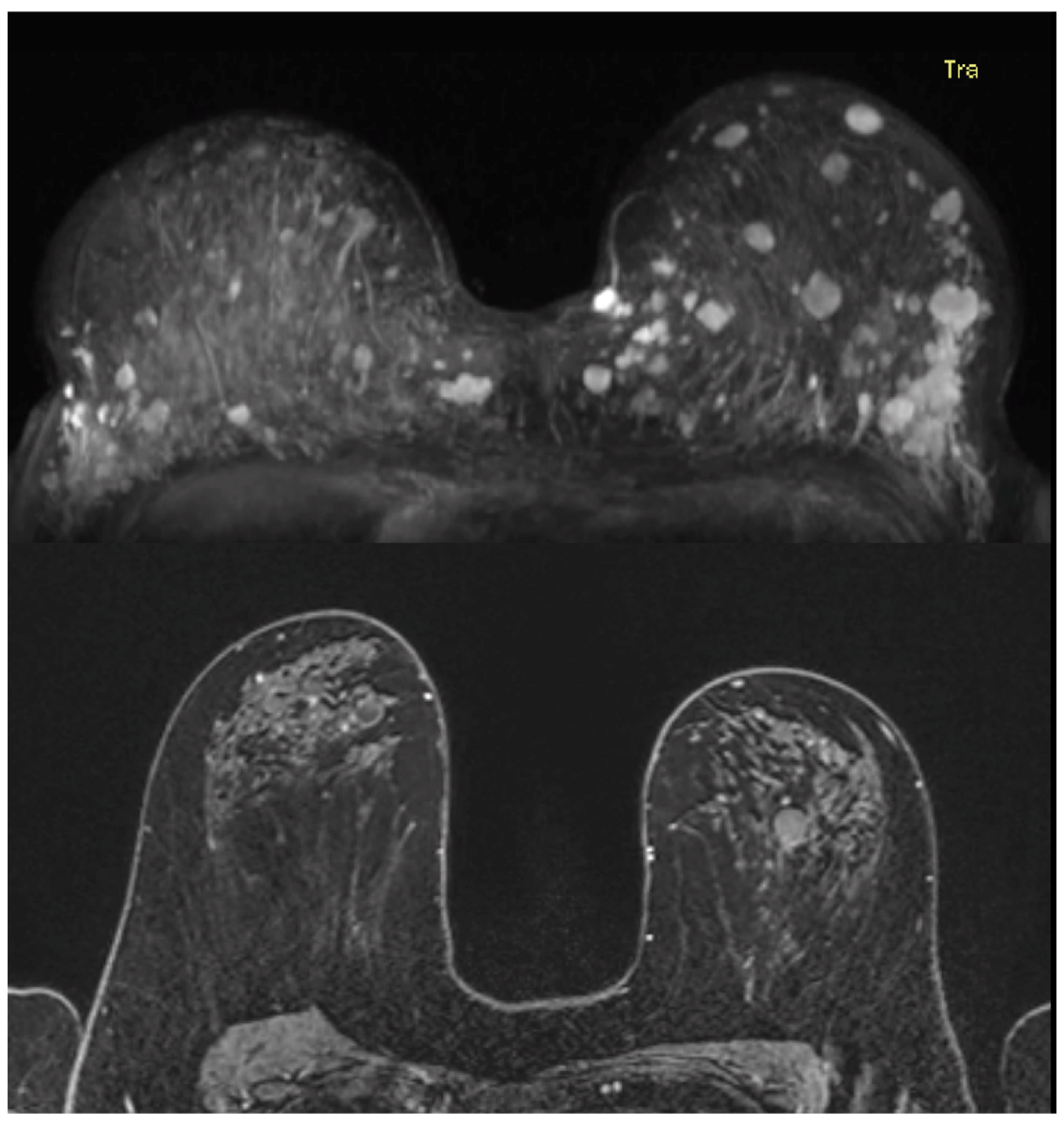 Cancers 17 00856 g007