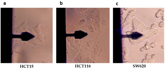 Atomic Force Microscopy: A Versatile Tool in Cancer Research