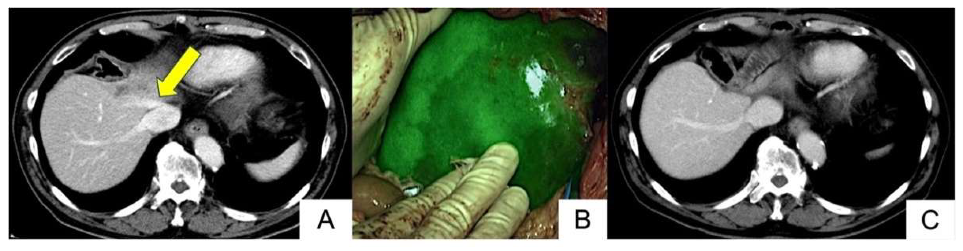 Cancers 17 00868 g001